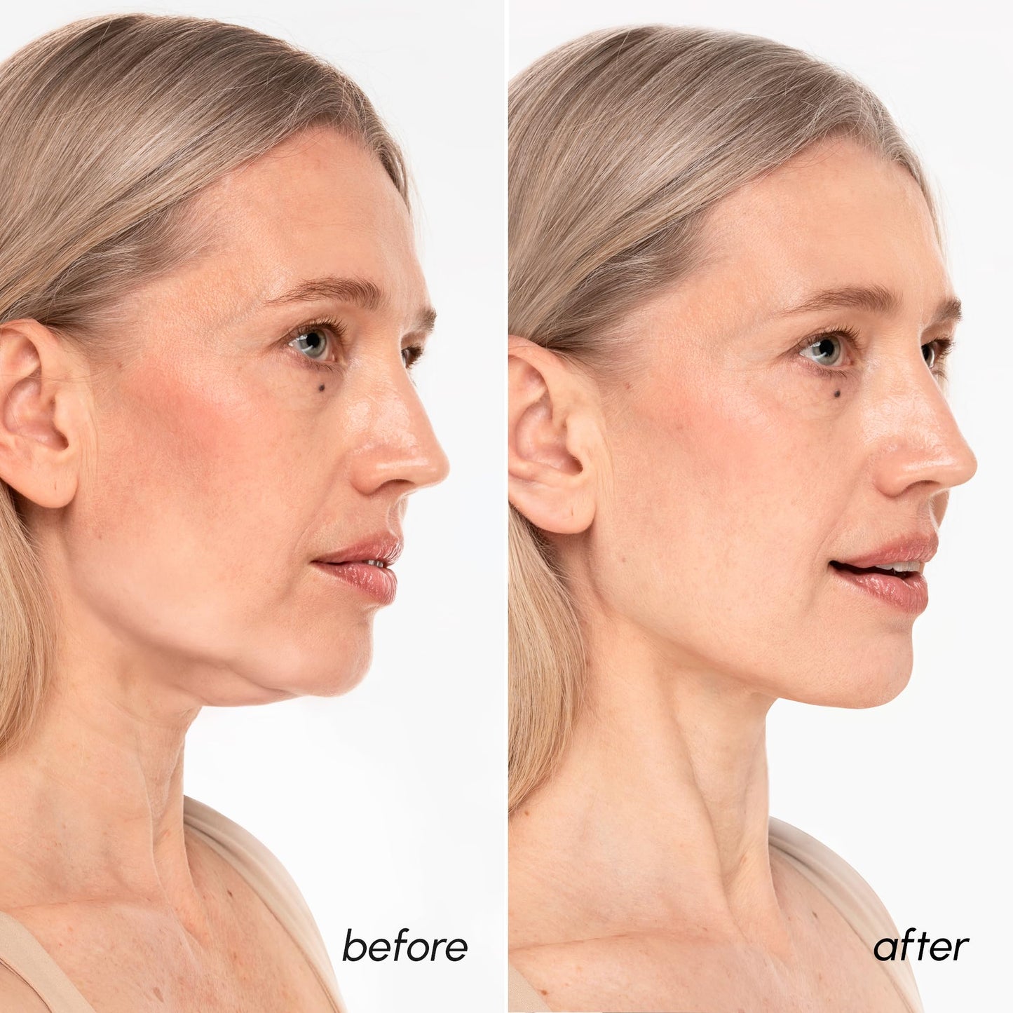 MAREE V-Lifting Mask PDRN Salmon DNA - Nourishing V-Lift Sheet Mask for Daily Skincare Routine Beauty and Personal Care MAREE
