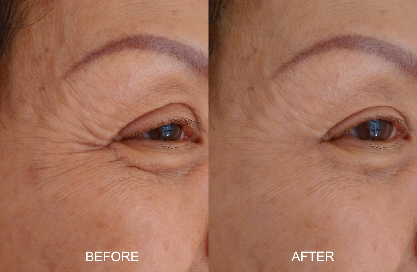 Magic Serum-No Needle Alternative-BioActive Argireline Peptides Complex Anti-Eexpression Line/Creases Serum-Matrixyl 3000, SNAP-8, Pentapeptide-18 Beauty & Personal Care DNA Code