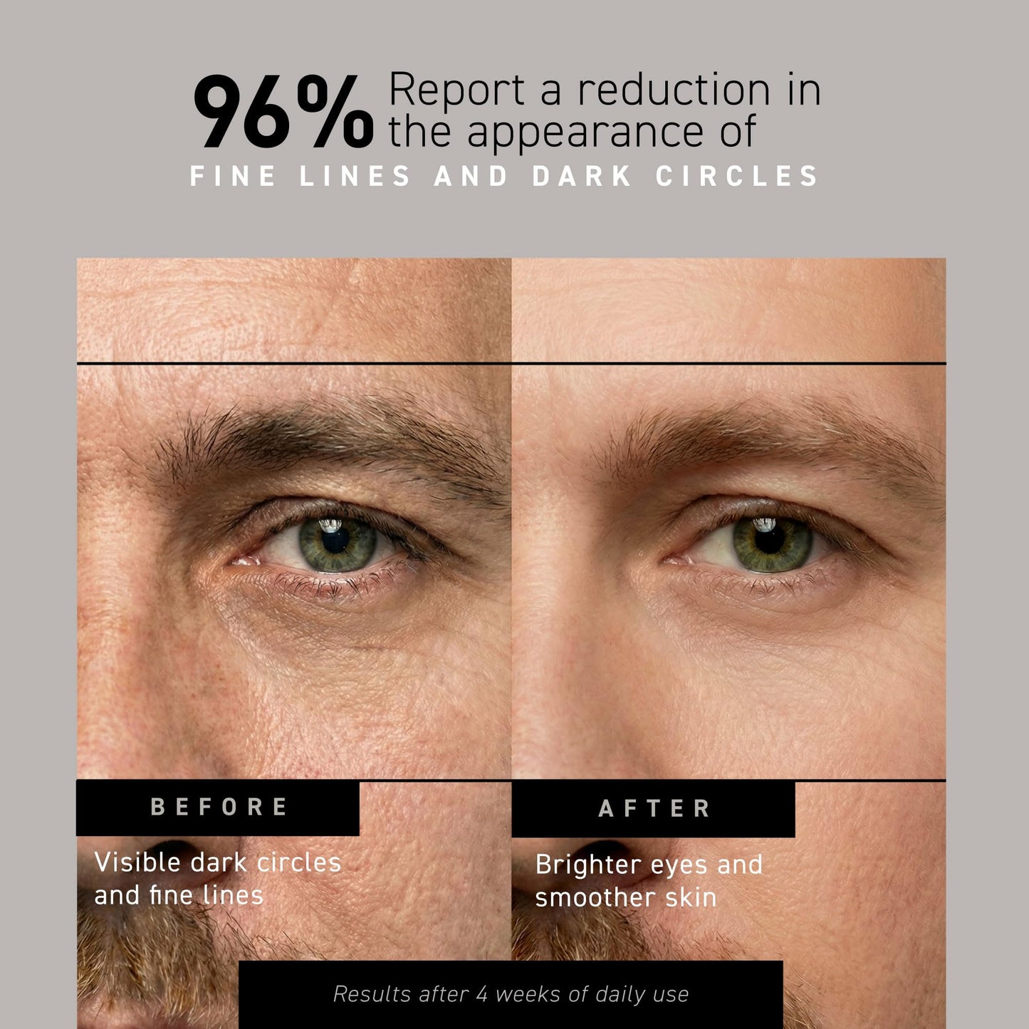 Brickell Men's Restoring Under Eye Cream for Men, Anti Aging Eye Balm To Reduce Puffiness, Wrinkles, Dark Circles, Crows Feet & Eye Bags, Caffeine Beauty & Personal Care Brickell Men's Products