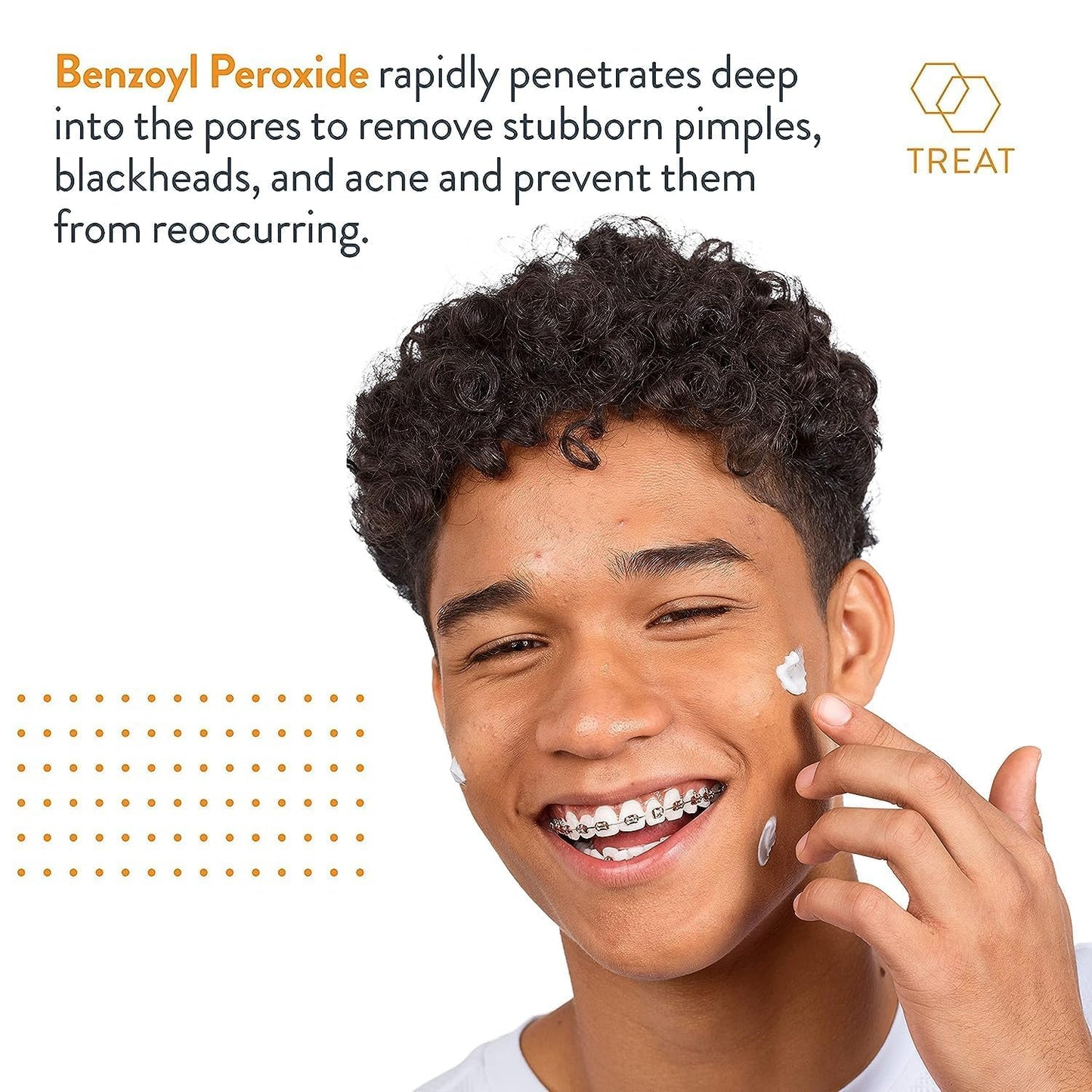 AcneFree Terminator 10 Acne Spot Treatment with Benzoyl Peroxide 10% Maximum Strength Acne Cream Treatment, 1 Ounce - Pack Of 1 Beauty & Personal Care AcneFree