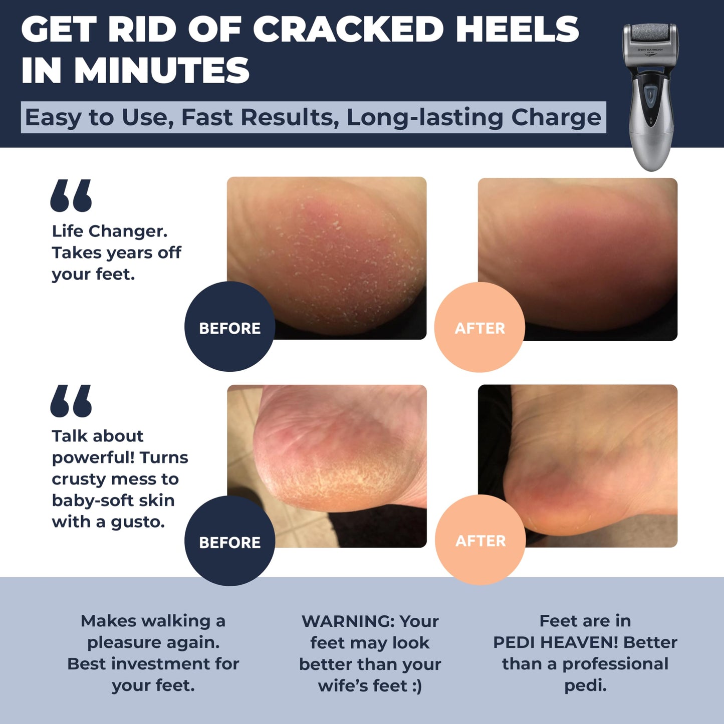 Electric Callus Remover: Rechargeable Electronic Foot File CR900 by Own Harmony(Tested Most Powerful) Best Pedicure Tools w 3 Rollers Professional Beauty & Personal Care Own Harmony