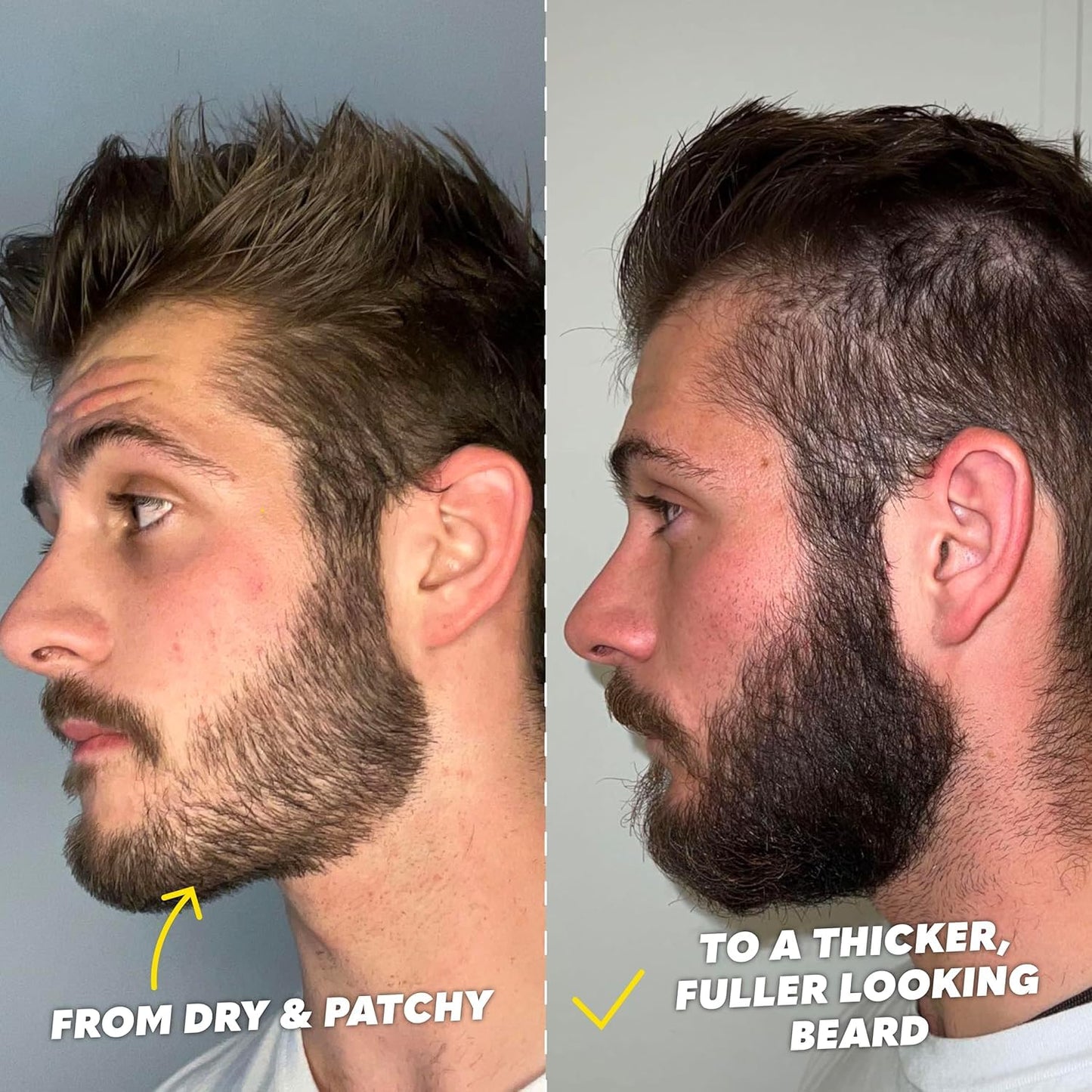 The Beard Club Supreme Beard Growth Kit - Derma Roller, Growth Oil, Vitamins, Vitamin Spray, Biotin Balm, Thickening Conditioner, Shampoo, Comb Beauty and Personal Care The Beard Club
