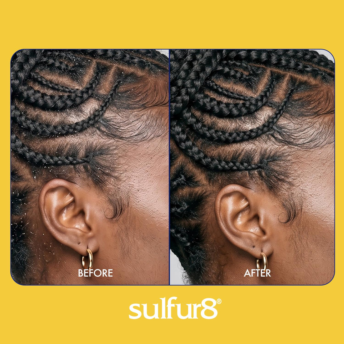 Sulfur 8 Dandruff Treatment For Braids 12 oz. Spray by Sulfur 8
