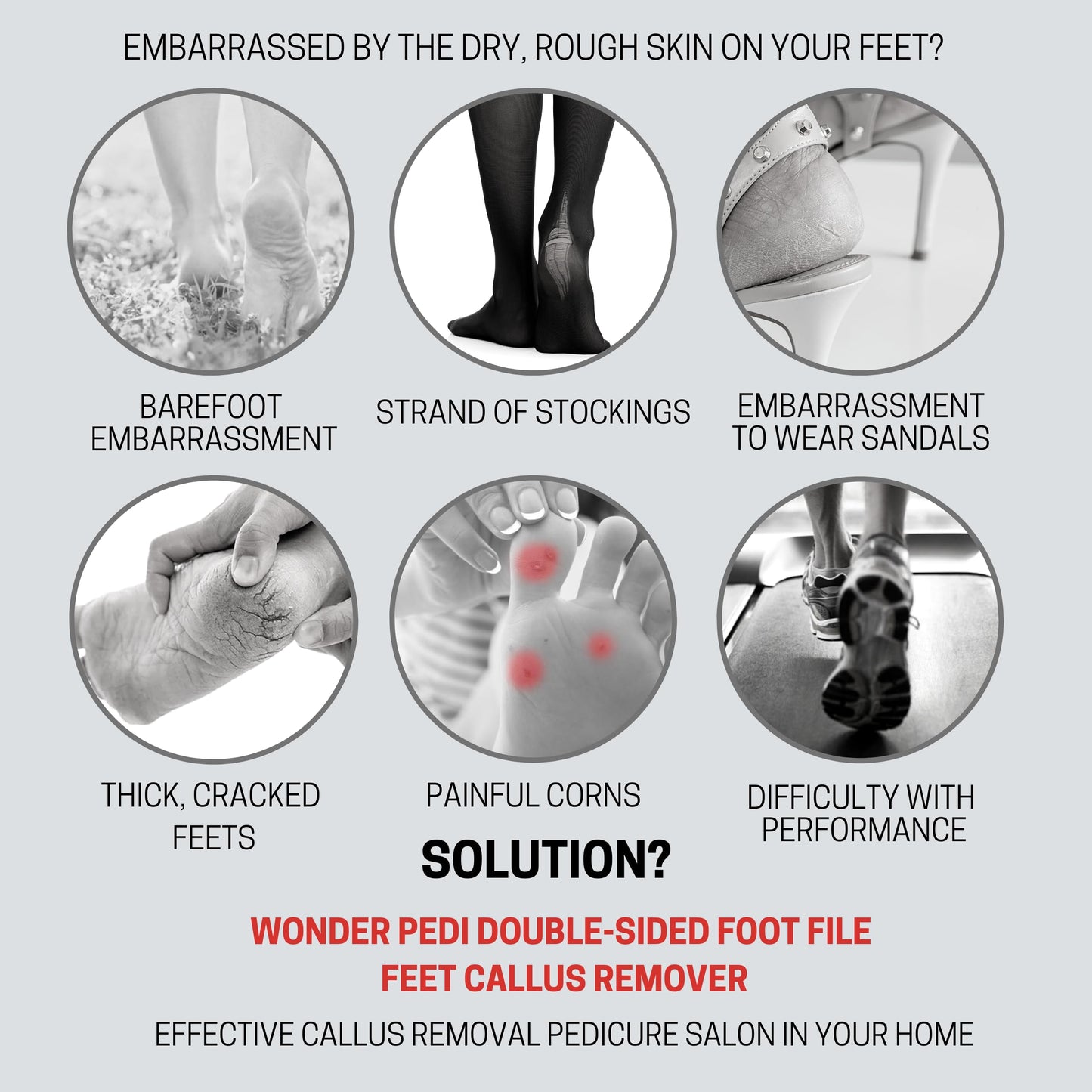 Made in Germany Double Sided Metal Foot File - Stainless Steel Feet Callus Remover - Feet Scrubber Dead Skin - Heel Scraper Cracked Heels Repair Beauty & Personal Care WONDER PEDI