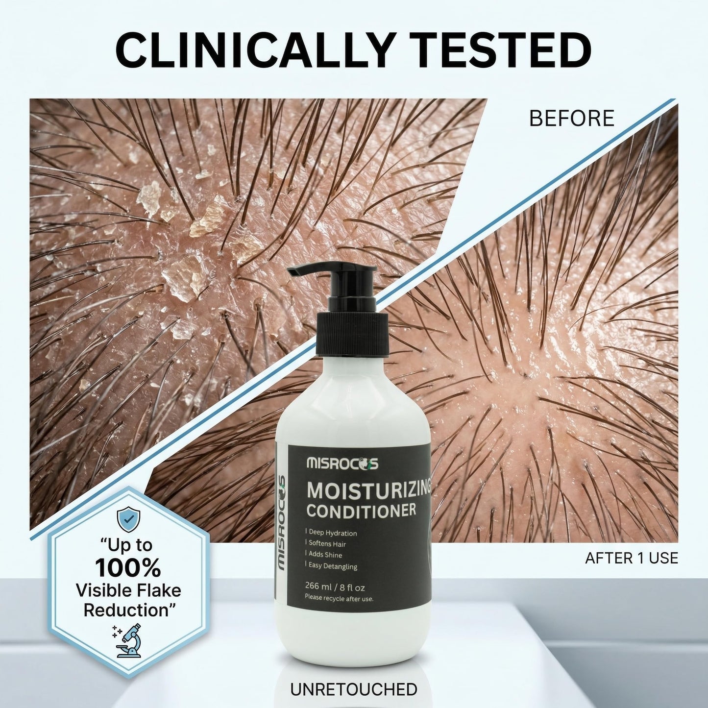 MISROCOS Moisturizing Conditioner & Anti-Dandruff Shampoo - Hair Care Essentials for Professional Scalp Care, Deep Hydration, Shine, Flake Control Beauty & Personal Care MISROCOS