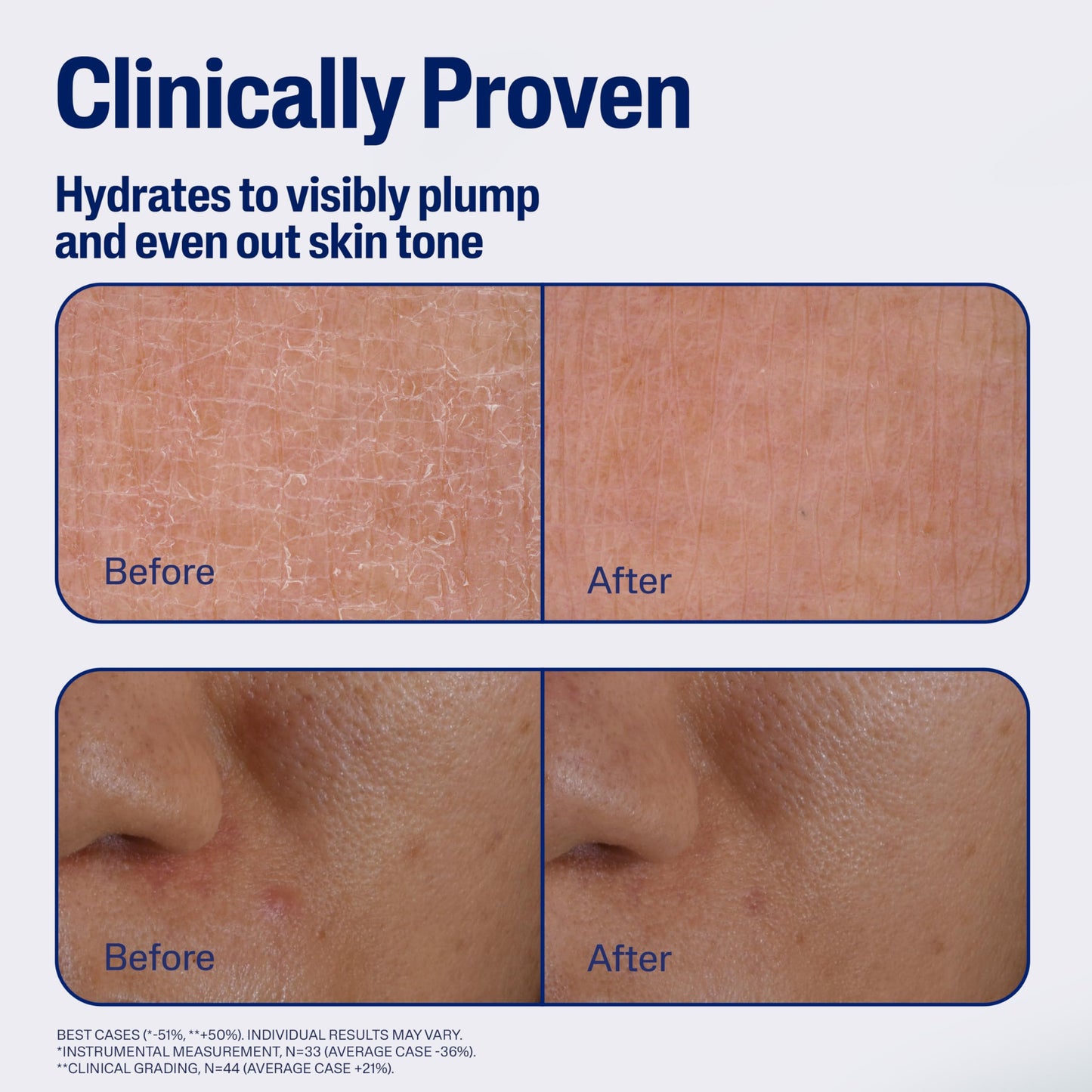 CETAPHIL Repair & Renew Night Serum for Stressed Sensitive Skin with Gallic Acid & Vitamin E, PM Face Serum, Repairs Skin Barrier Overnight Beauty & Personal Care Cetaphil