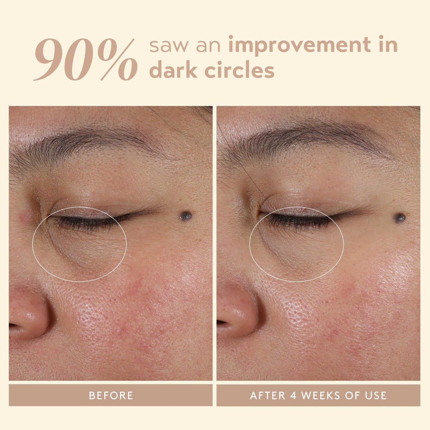 SHANI DARDEN Intensive Eye Renewal Cream, Hydrating Under Eye Cream for Dark Circles, Fine Lines, Wrinkles & Crows Feet with Niacinamide, Shea Butter Beauty & Personal Care SHANI DARDEN