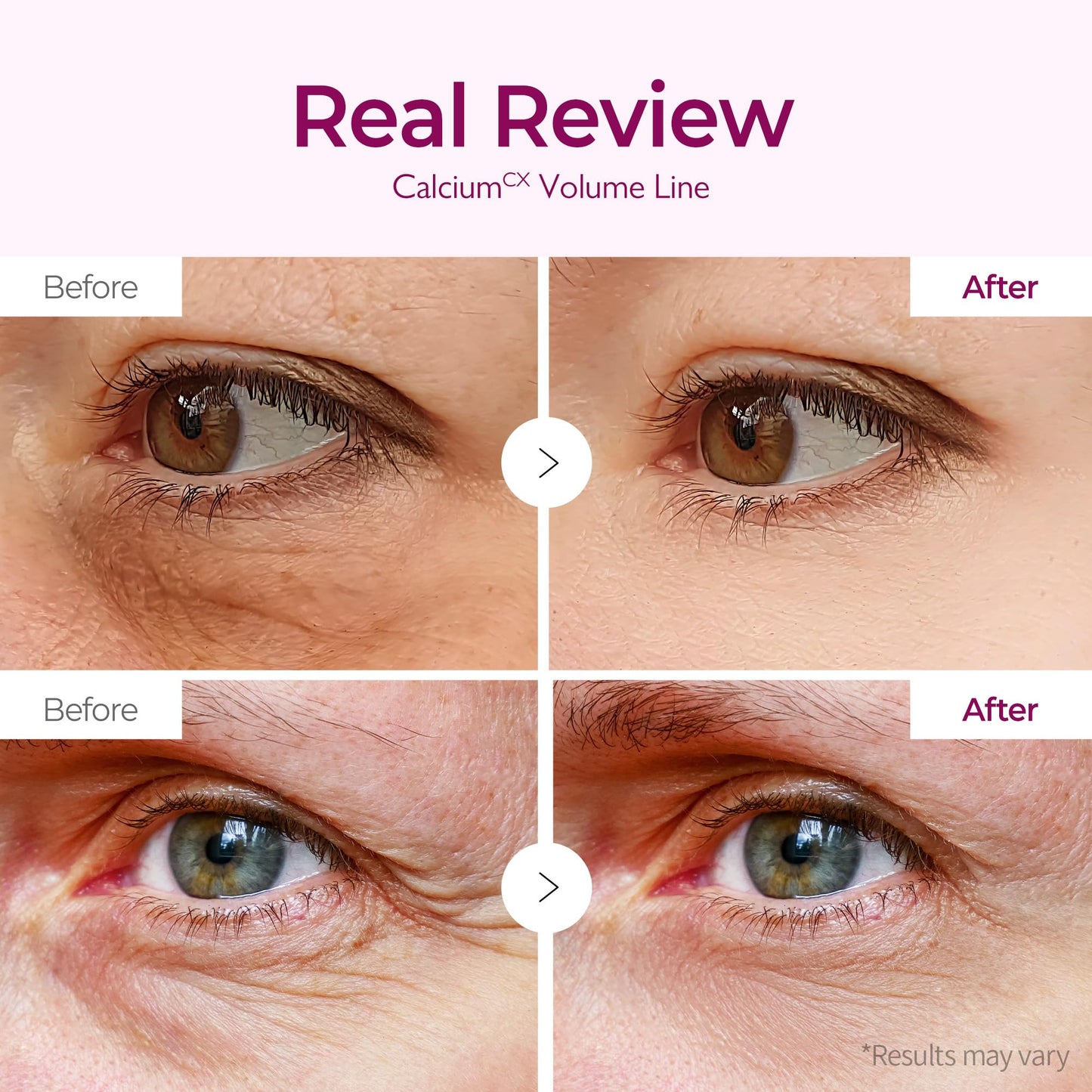 Dr.Melaxin Calcium Volume Under Eye Patches for Puffy Eyes & Dark Circles, Hydrogel Eye Mask for Wrinkles, Fine Lines & Sagging Skin, Firming Collagen Beauty and Personal Care Dr.Melaxin