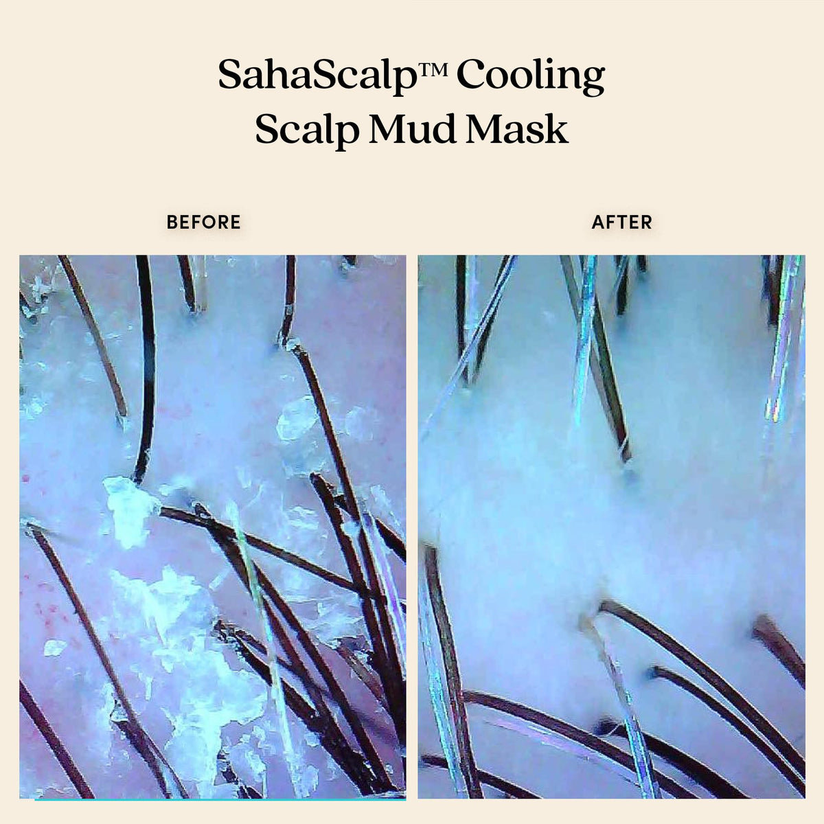 Fable & Mane Cooling Scalp Mud Mask, Soothes Itchiness and irritation. Treatment to Purify the Scalp with Ayurvedic Neem