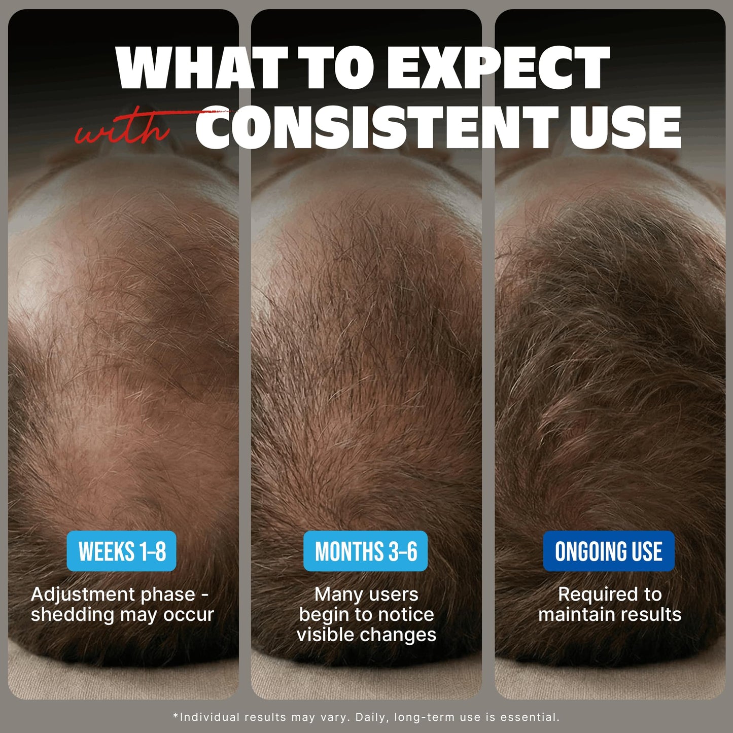 Minoxidil Liquid Extra Strength Hair Regrowth Treatment for Men, 5% Topical Solution, 6 Months Supply - Dropper Applicator and Bonus Free Beauty and Personal Care KIRKLAND