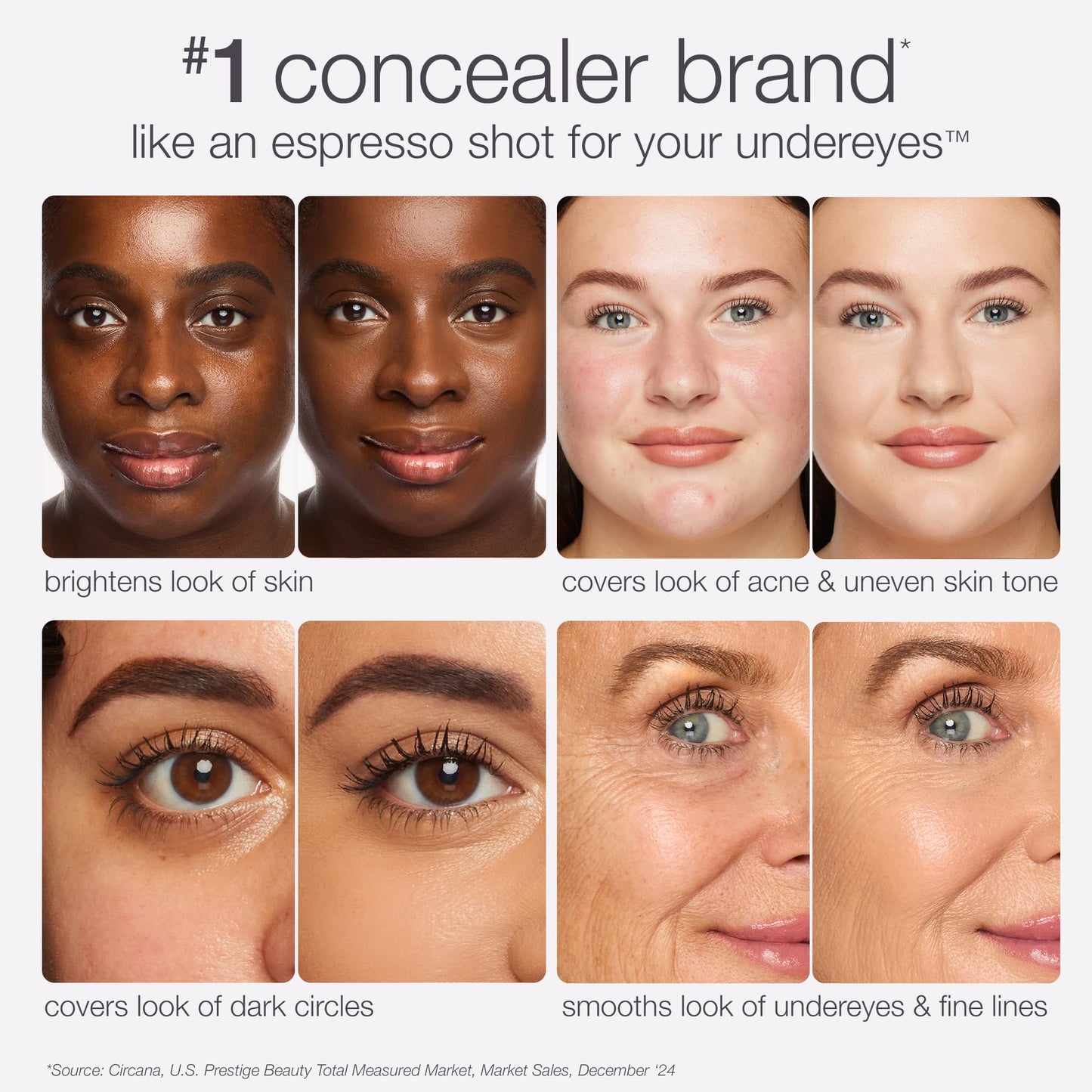 tarte shape tape creamy concealer - Full Coverage Makeup with Built-In Eye Cream, 24HR Hydrating Natural Moisturizing Matte Finish for Redness & Fine Beauty & Personal Care tarte