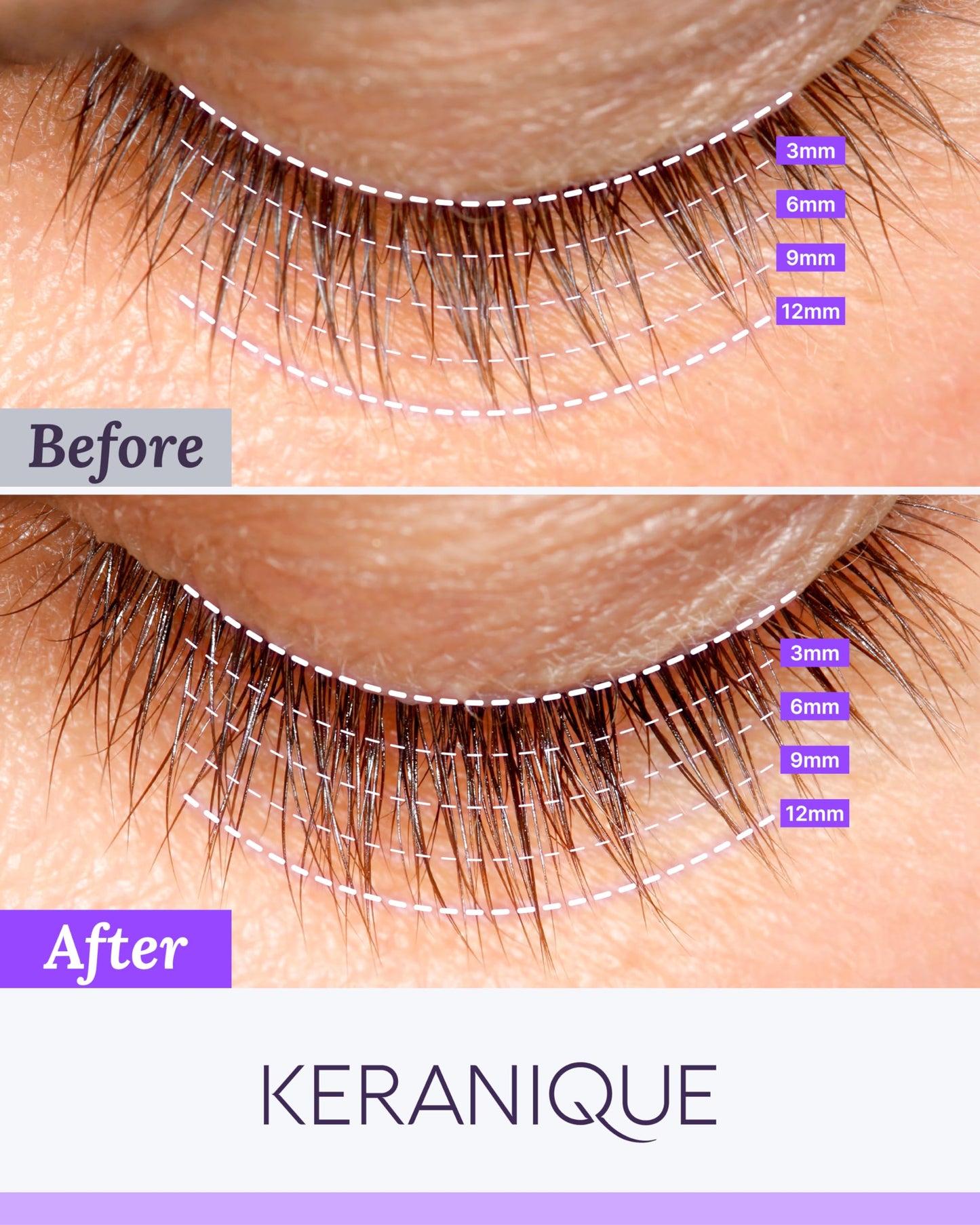Keranique Lash Growth Serum - Eyelash Enhancer for Women with Thin & Brittle Lashes - Intense Boost for Long, Natural Eyelashes Beauty & Personal Care Keranique