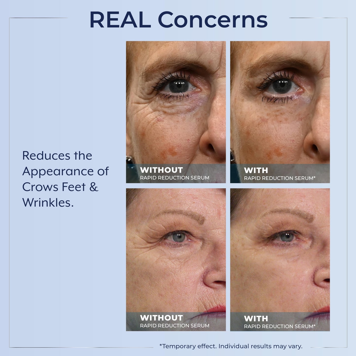 Plexaderm Rapid Reduction Eye Serum - Visibly Reduces Under-Eye Bags, Wrinkles, Dark Circles, Fine Lines & Crow's Feet Instantly, Anti Aging Wrinkle Beauty & Personal Care Plexaderm