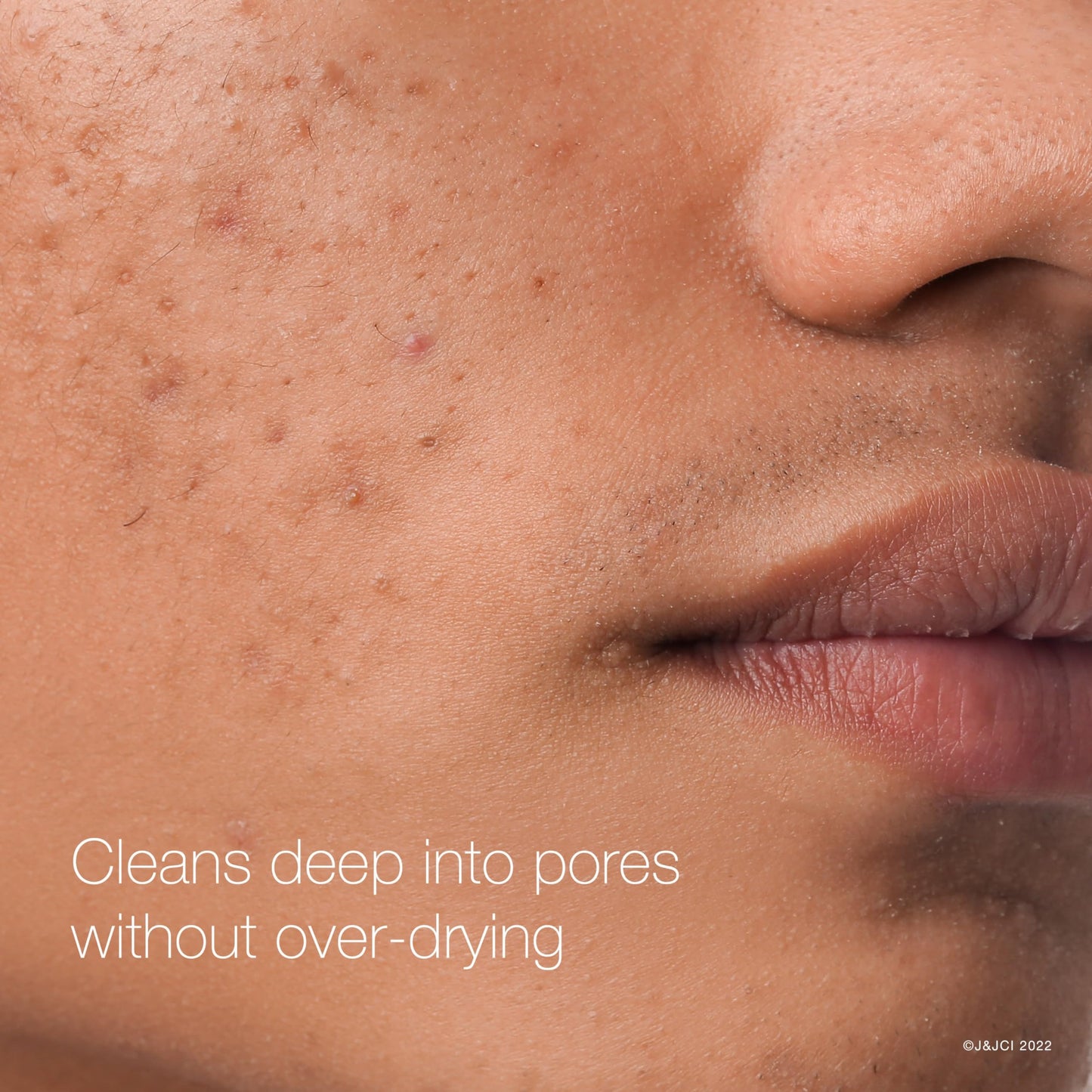 Neutrogena Rapid Clear Maximum Strength Acne Face Pads with 2% Salicylic Acid Acne Medication to Help Fight Breakouts, Oil-Free Facial Cleansing Pads Beauty & Personal Care Neutrogena