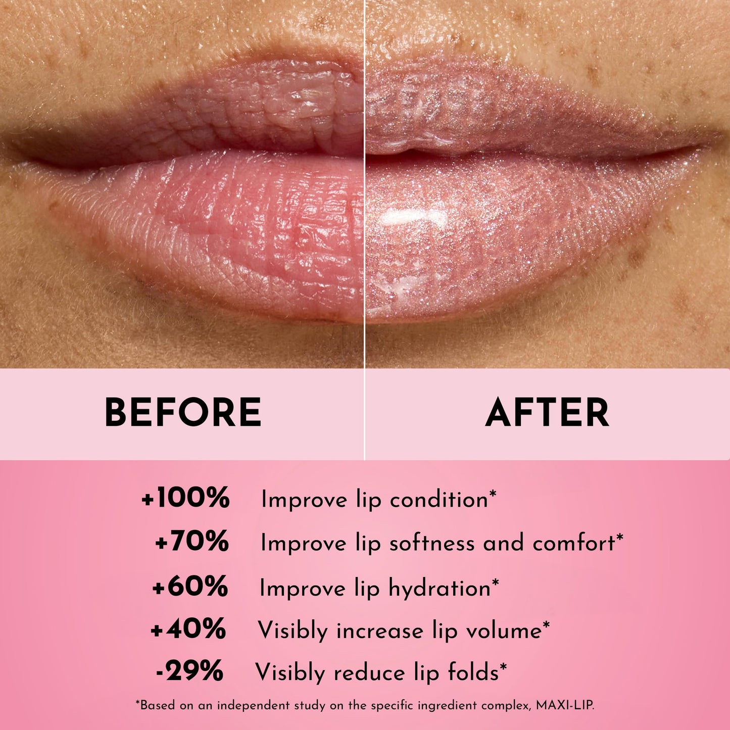 Lawless Forget the Filler Lip Plumping Line Smoothing Gloss - Daisette - Premium Volumizing Lip Gloss with Natural Ingredients Designed to Plump, Beauty & Personal Care Lawless