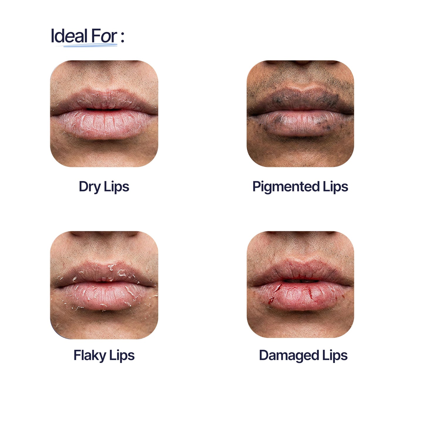Mannlich Lip Balm For Men Lip Care With Spf 50 Pa++++ Protection - Lip Lightening For Dry & Chapped Lips - Moisturizes, Long-Lasting Hydration With 2% Beauty and Personal Care Mannlich