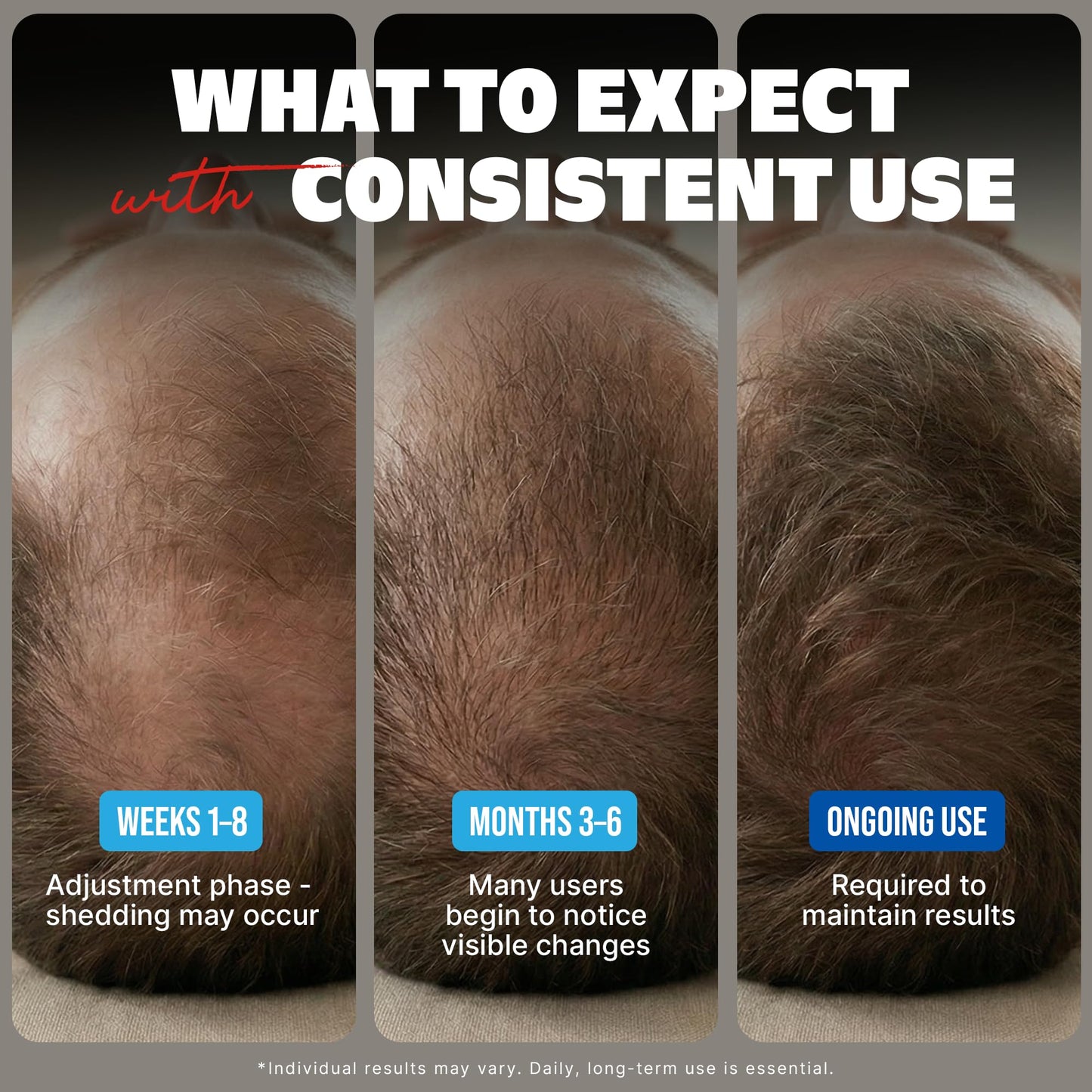 Kirkland Minoxidil for Men Liquid, Extra Strength Hair Regrowth Treatment 5%, 6 Months Supply - Upgraded Dropper Applicator and Bonus Free Guide Beauty and Personal Care KIRKLAND