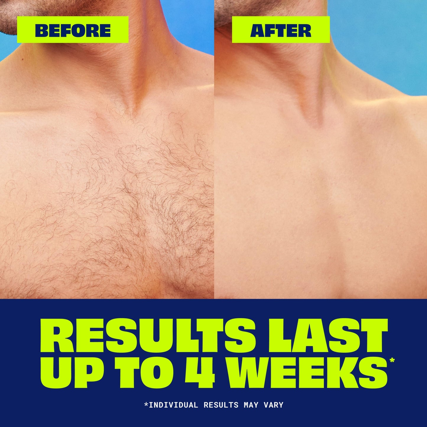 Nair Men Hair Remover Body Cream, Quick and Easy Body Hair Removal Cream for Men, Aloe and Lanolin, Dermatologist Tested, 12 Oz Beauty & Personal Care Nair
