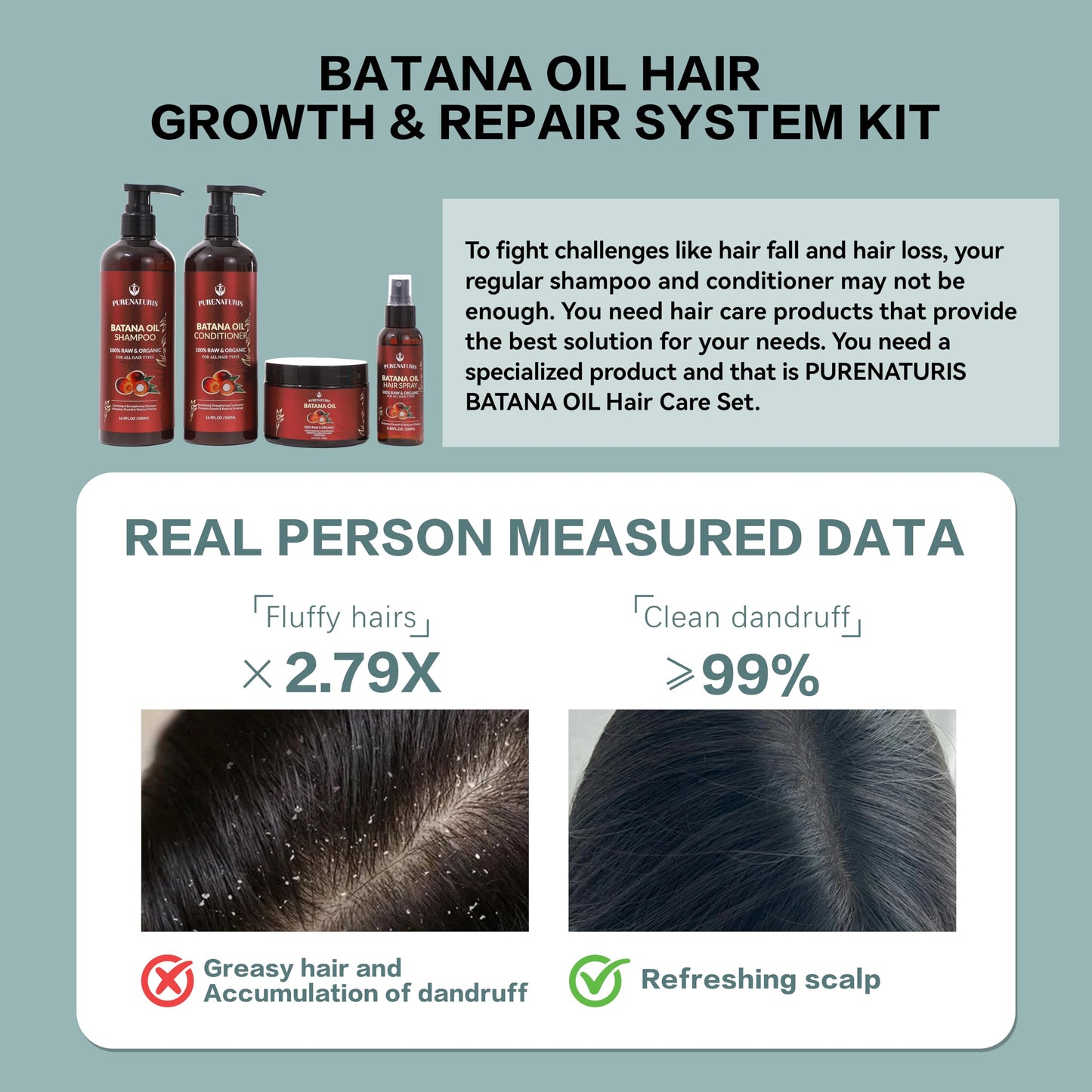 100% Natural Raw Organic Batana Oil Sulfate-Free Complete Hair Growth , Anti-Hair Loss & Repair System Kit - Shampoo, Conditioner, Hair Mask Beauty & Personal Care PureNaturis