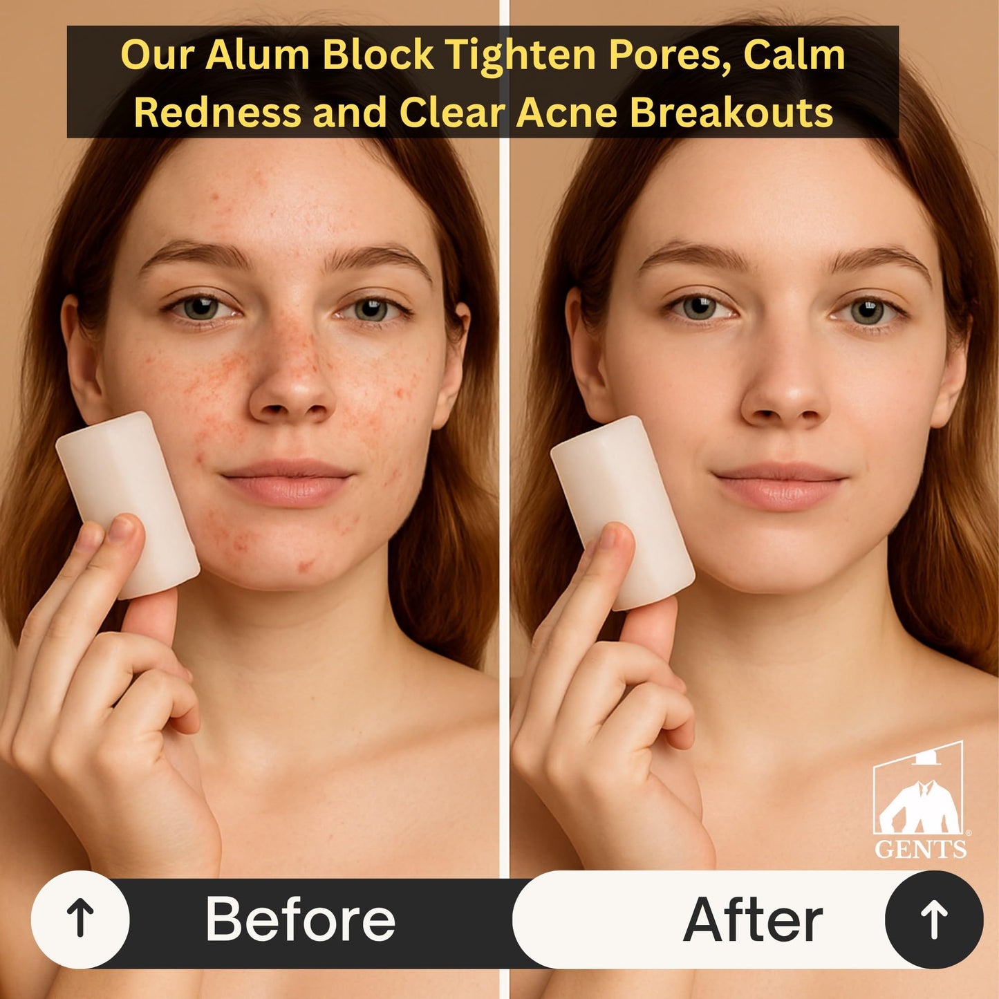 Gents Alum Block in Plastic Case - Upgrade Your Shave - Soothing Aftershave Solution for Shaving Razor Burn Relief - Travel Friendly Durable Plastic Beauty and Personal Care G.B.S