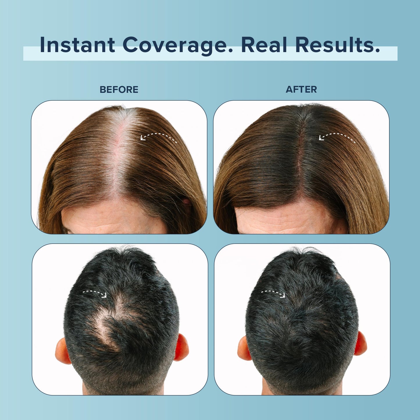TRUHAIR Color Fibers Root Coverage and Density Booster Refill | Quick-Apply Touch Up Hair Color | Natural Matching, Gray Hair Cover Up - 11 Colors Beauty & Personal Care Truhair