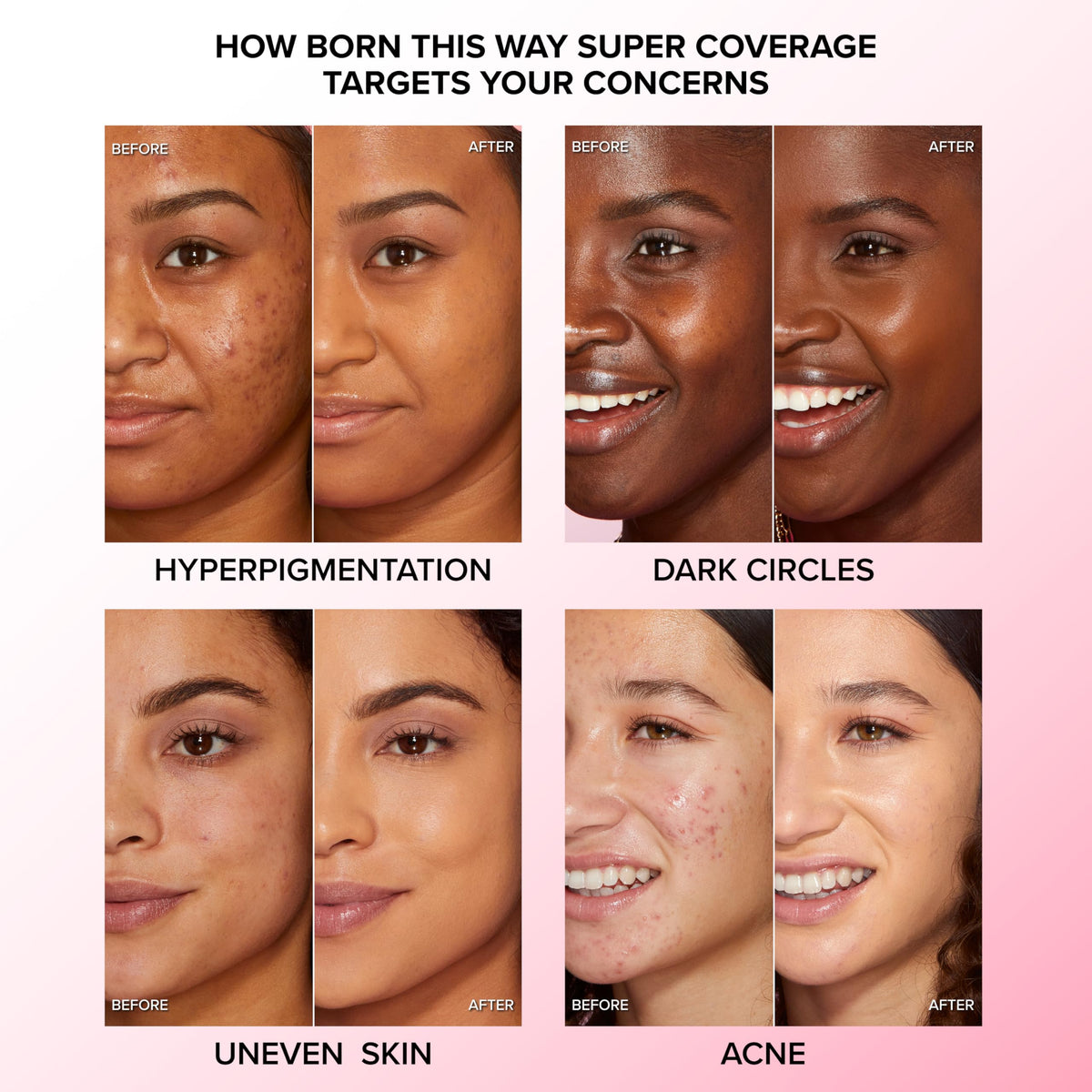 Too Faced Born This Way Super Coverage Multi-Use Concealer | Full Coverage, Non-Comedogenic, Oil Free + Long Lasting Concealer | Hyaluronic Acid Beauty & Personal Care Too Faced