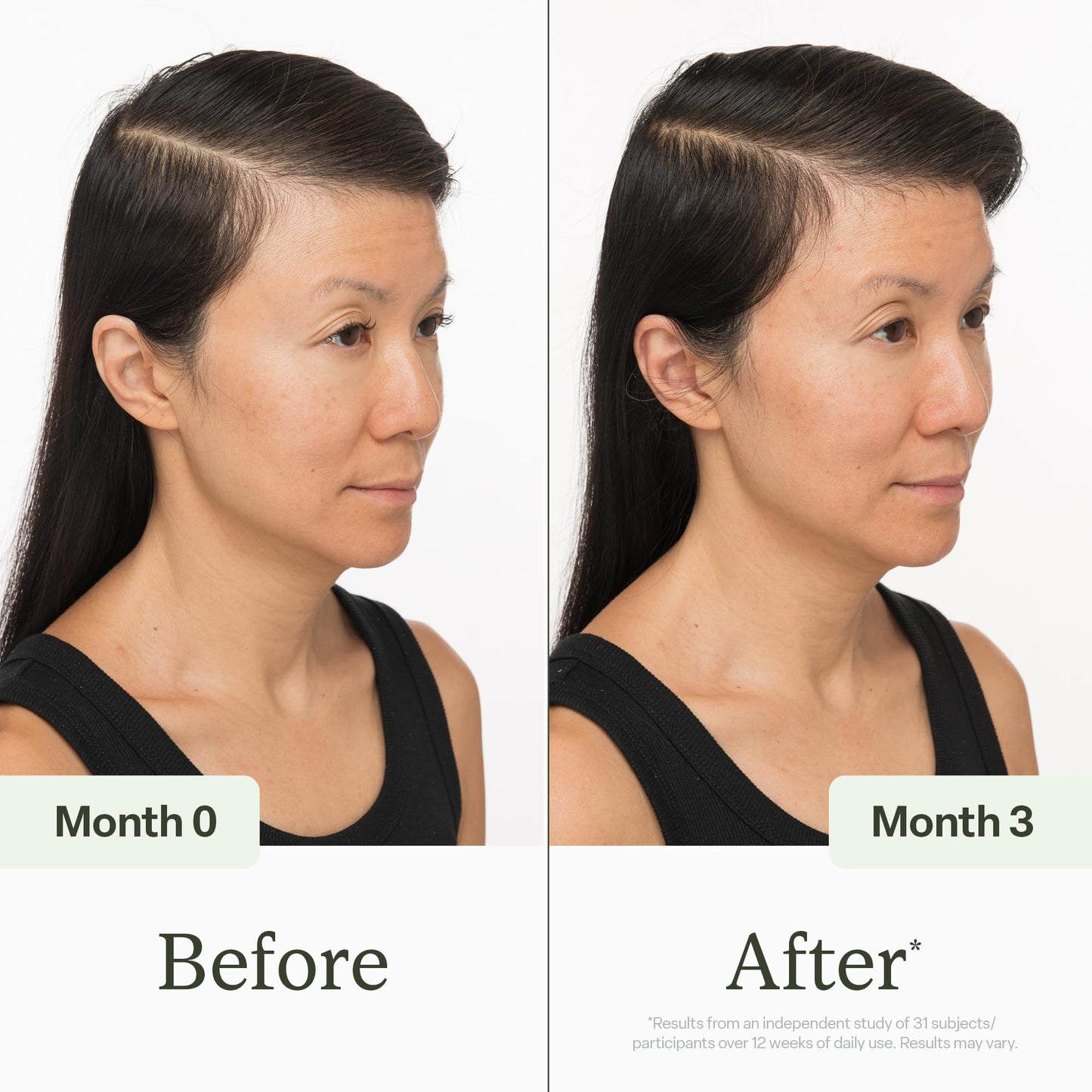 Divi Scalp Serum | To Promote Fuller-Looking Hair with Peptides | 30ml Beauty and Personal Care divi