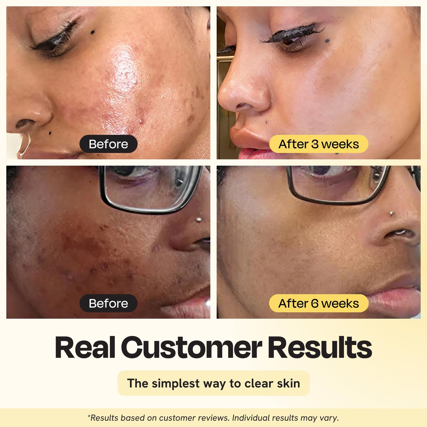 Gleamin Vitamin C Clay Mask for Dark Spots, Turmeric Clay Face Mask Skin Care, Deeply Cleanses & Refines Pores, Brightens Uneven Tone and Helps Beauty & Personal Care Gleamin