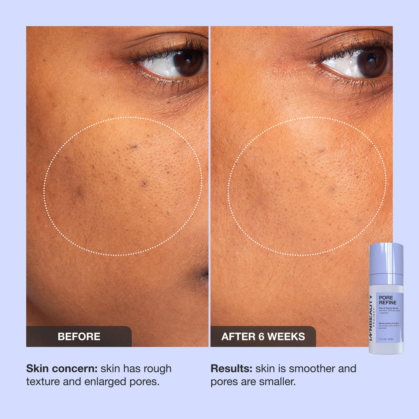 INNBEAUTY Project Pore Refine Serum for Shrinking Pores & Texture Smoothing, 1 OZ (30ml) Beauty & Personal Care Innbeauty Project