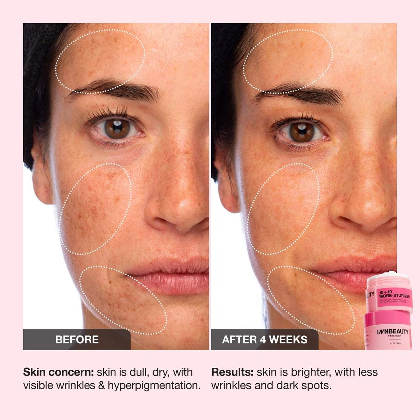 Innbeauty Project 10+10 Daily Moisturizer with 10% Vitamin C + 10% Peptide Complex + Ceramides, 1.7 OZ (50ml) Beauty & Personal Care Innbeauty Project
