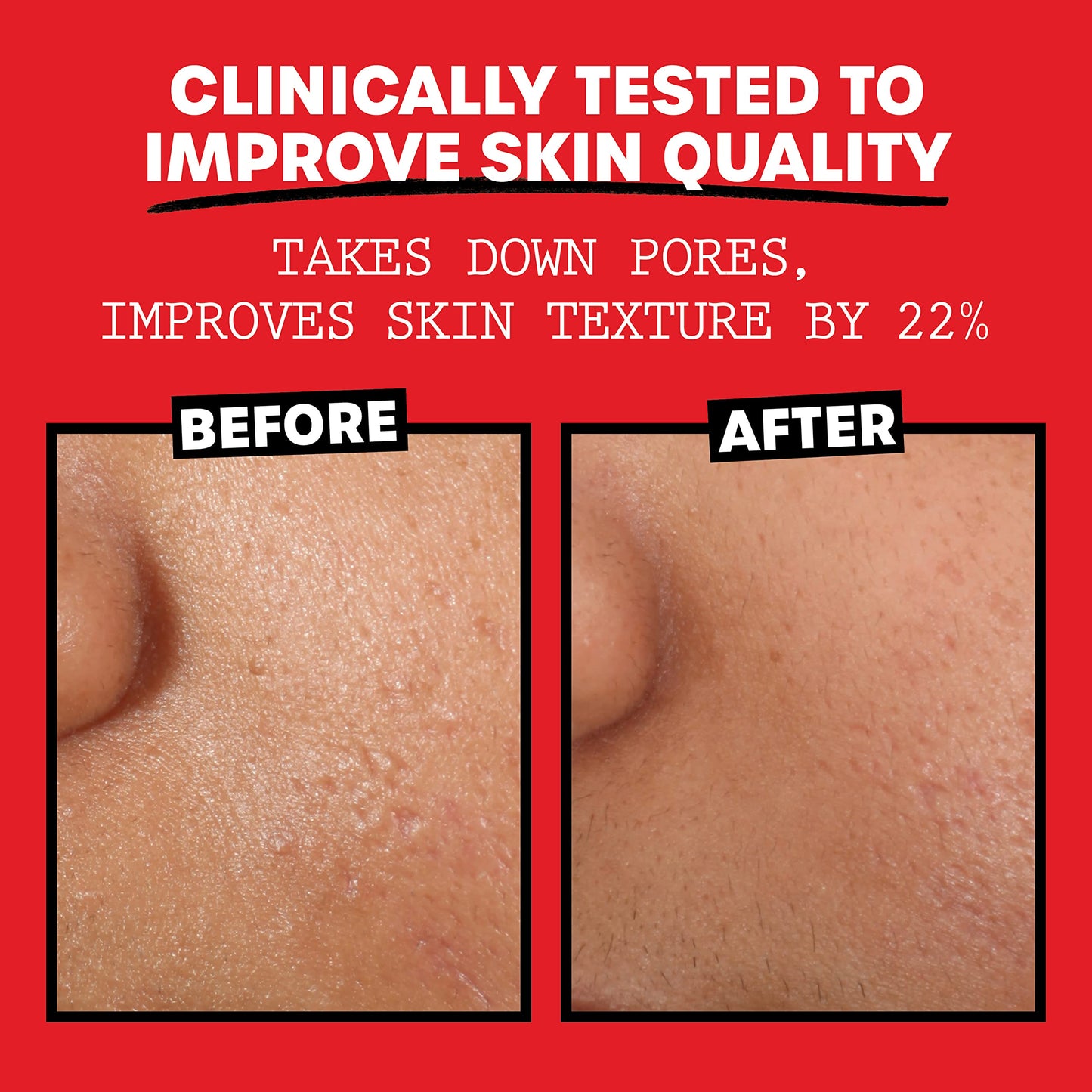 THAYERS Alcohol-Free, Hydrating Rose Petal Witch Hazel Facial Toner with Aloe Vera Formula, Vegan, Dermatologist Tested and Recommended, 12 Oz (Pack Beauty & Personal Care THAYERS