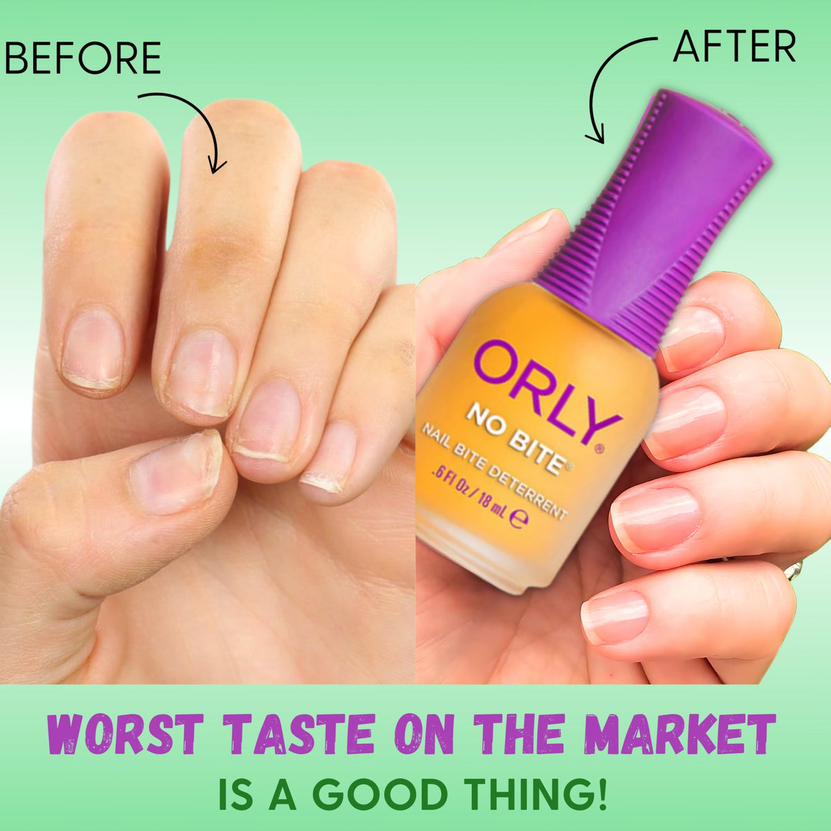 ORLY Nail Treatment No Bite | Nail Biting Deterrent & Bitter-Tasting Formula To Help Stop Adults And Children From Nail Biting | Vegan, Non-Toxic Beauty & Personal Care Orly