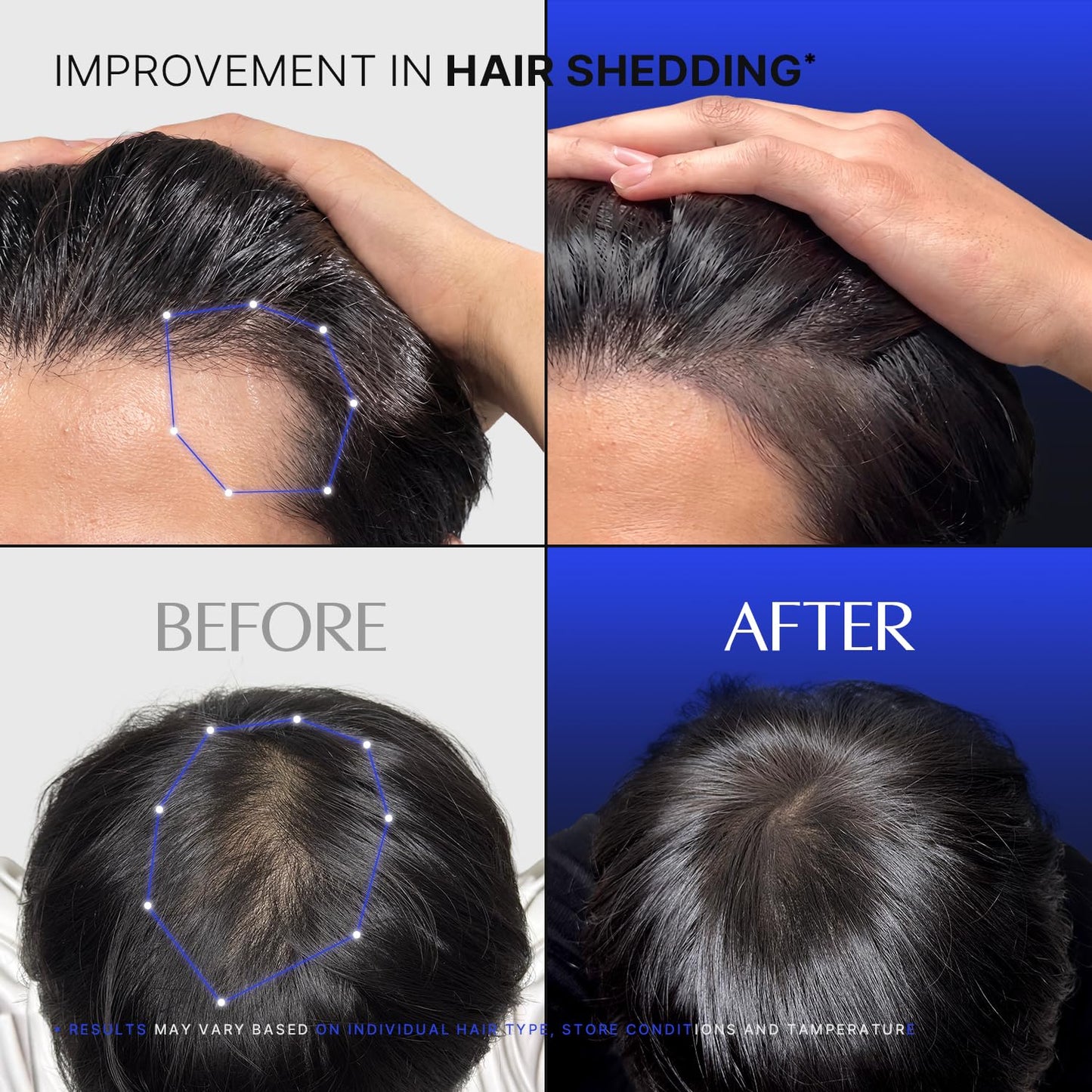 lilyeve GROWTURN Exosome Brush Ampoule Prime for Man, Built-in Brush, Heartleaf-Derived Exosomes to Revitalize, for Male Pattern Hair Loss, Korean Beauty and Personal Care lilyeve