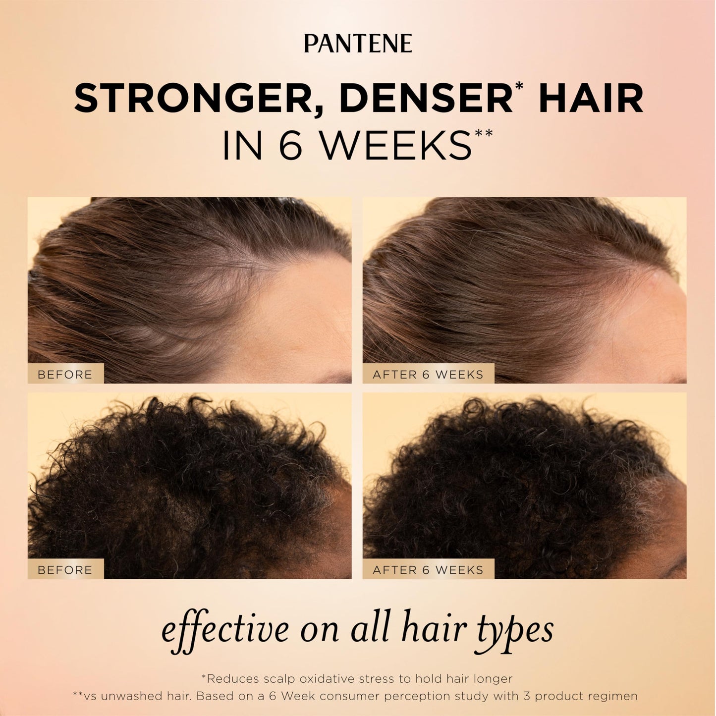 Pantene Abundant & Strong 3-Piece Regimen with B5 Complex + Niacinamide, Shampoo (13.5 oz), Conditioner (8 oz), Serum (2 oz) for Hair Loss, Thinning Beauty & Personal Care Pantene
