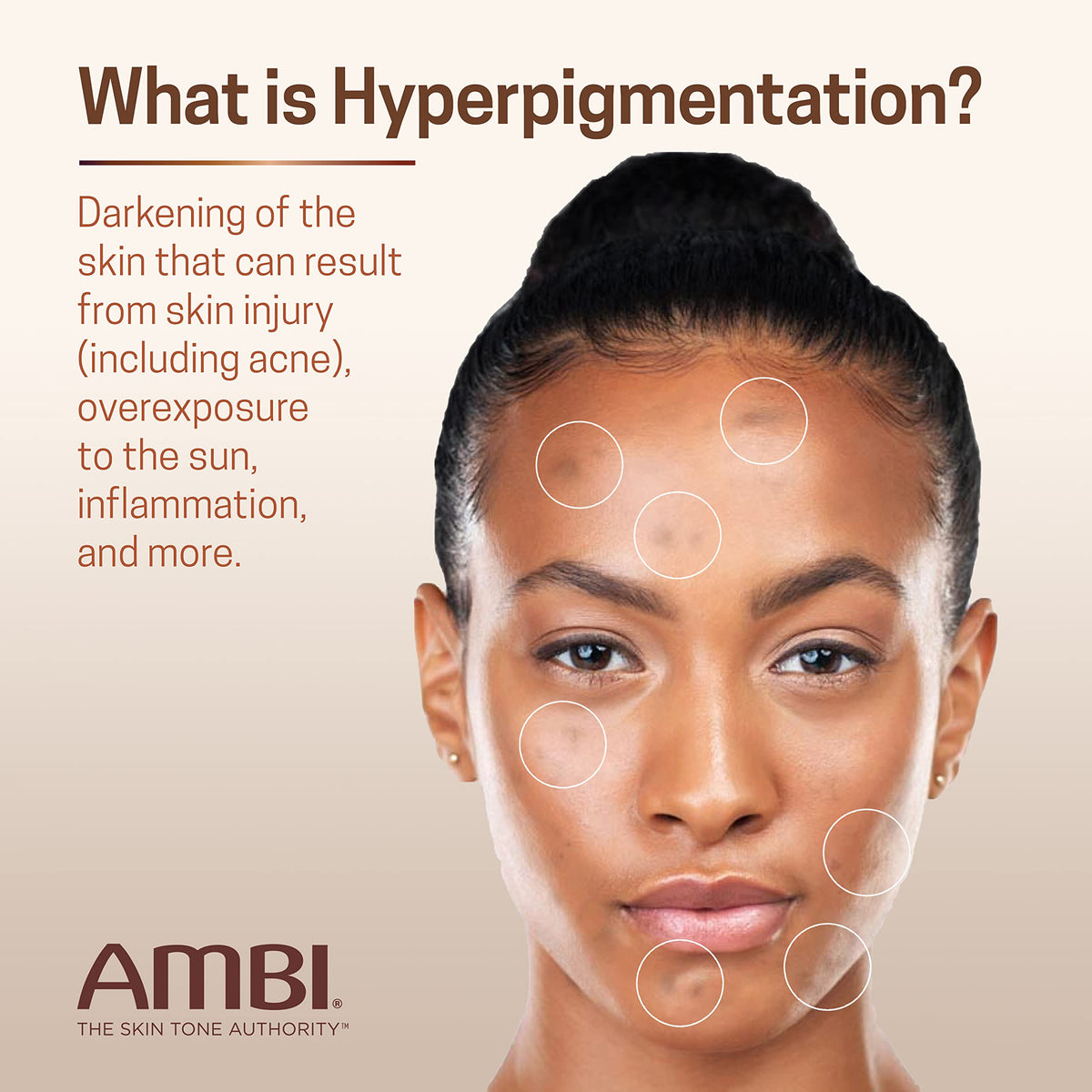 Ambi Even & Clear Advanced Fade Cream, Hydroquinone-free, Hyperpigmentation Treatment, Stubborn Dark Spot Corrector, Results In As Little As 2-3 Beauty & Personal Care Ambi