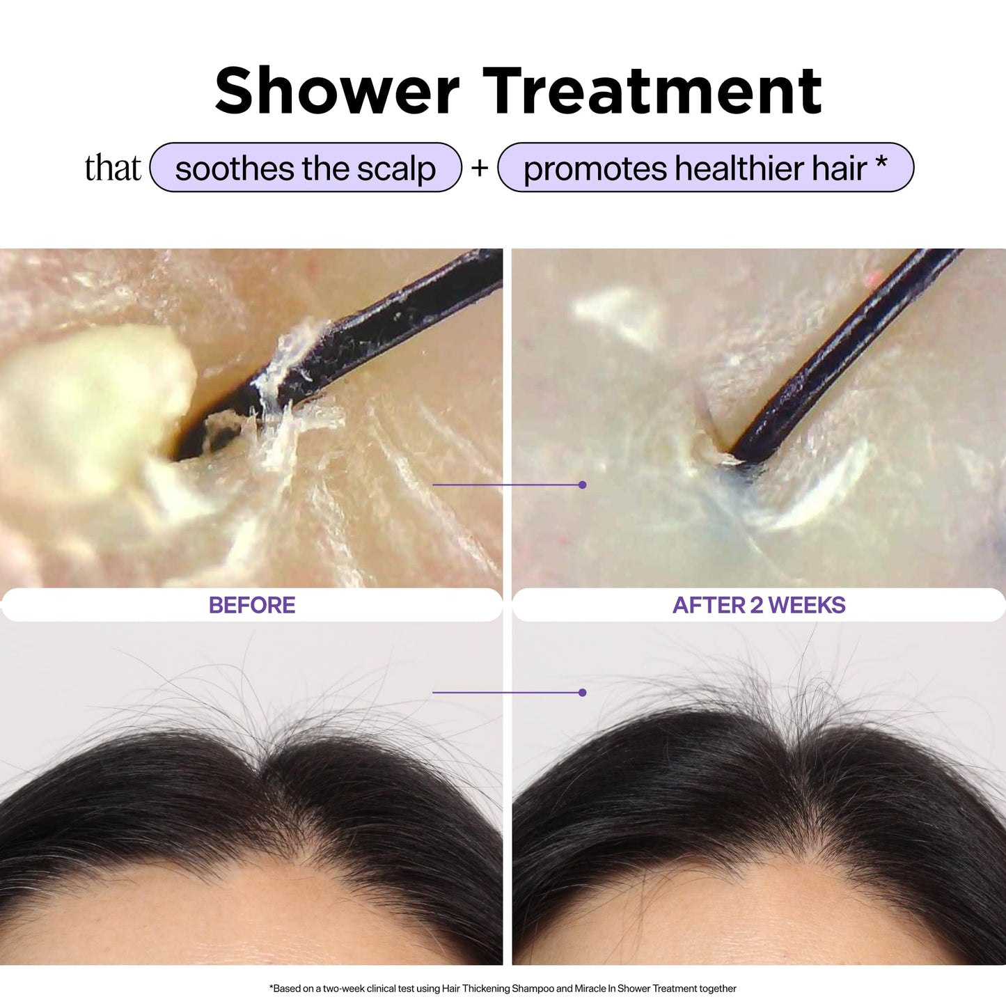 Dr. Groot Miracle in Shower Moisturizing Treatment for Hair Loss, Korean Hair Care Rinse, Rosemary Oil for Smooth, Healthier-Looking Hair in 5 Beauty and Personal Care Dr. Groot