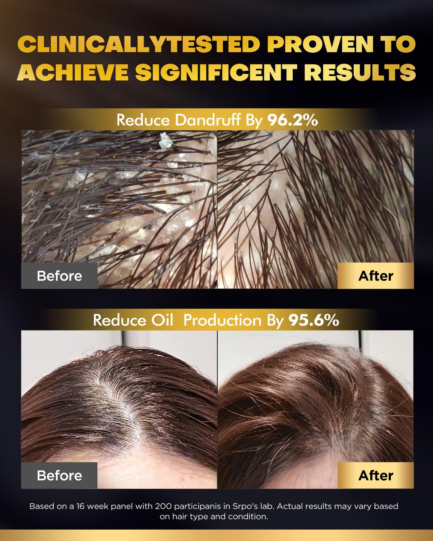 COOLKESI Tripeptide-Infused Biotin Hair Growth Shampoo and Conditioner Set, Onion Anti-Loss Volumizing Moisturizing Treatment for Soft Shine Hair Beauty & Personal Care COOLKESI