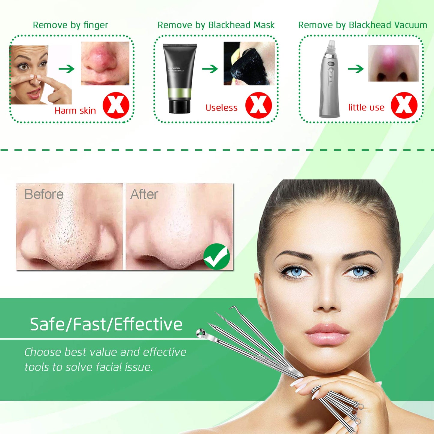 5PCS Blackhead Remover Comedone Extractor, Curved Blackhead Tweezers Kit, Professional Stainless Pimple Acne Blemish Removal Tools Kit for Manual Beauty & Personal Care UWOIST