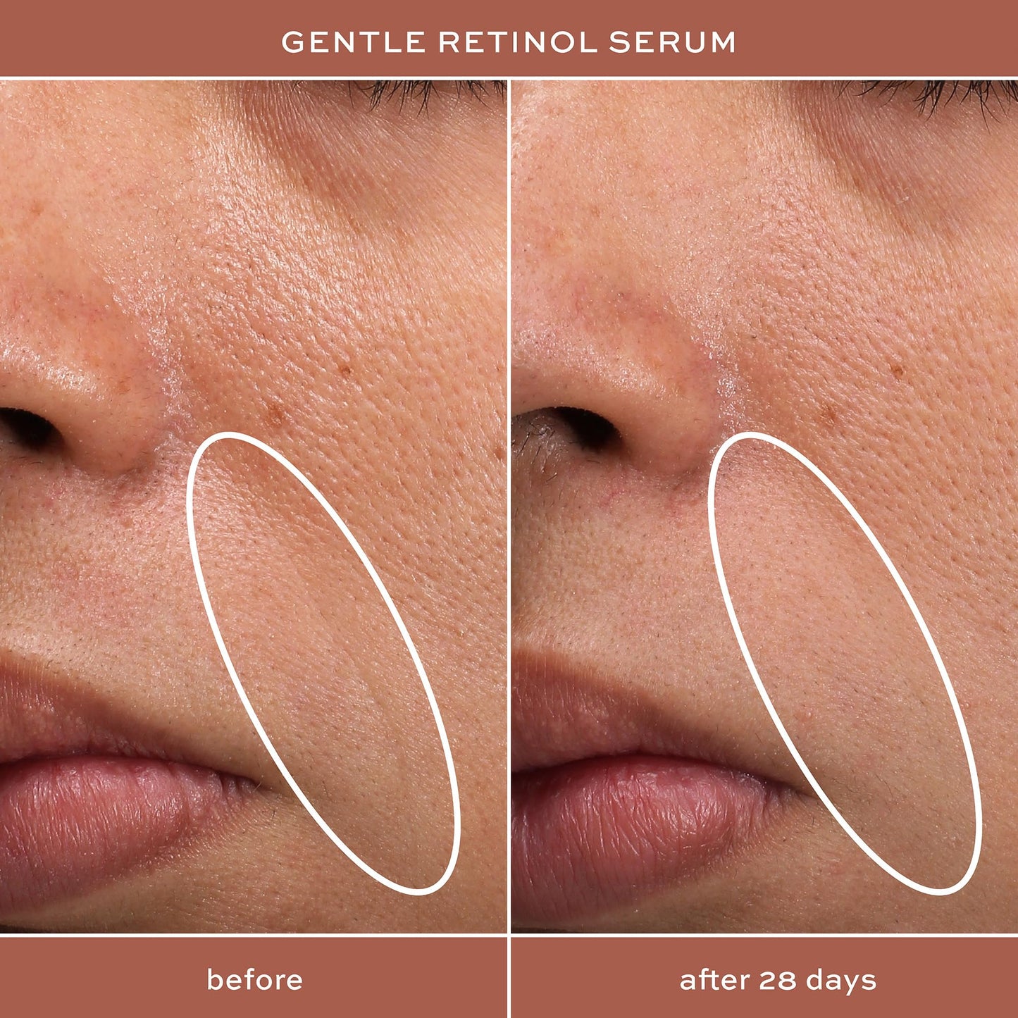 ITK Skincare Gentle Hydrating Nightly Retinol Facial Serum for All Skin Types, 1 oz Beauty & Personal Care ITK