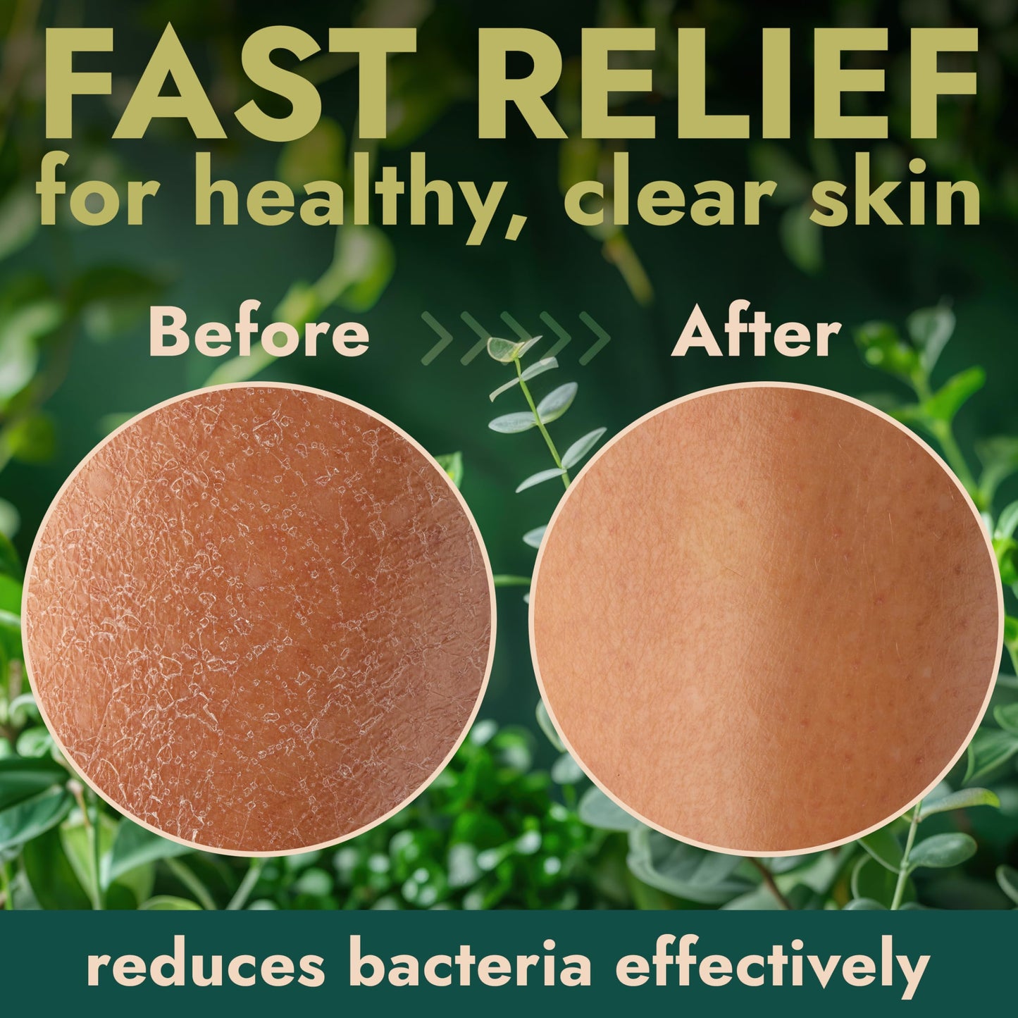 Antibacterial Body Wash | Antibacterial Soap for Men & Women | Kills 99.9% of Germs & Bacteria | Helps with Back Acne, Body Odor & Skin Irritation | Beauty and Personal Care Terramed Just Think Comfort