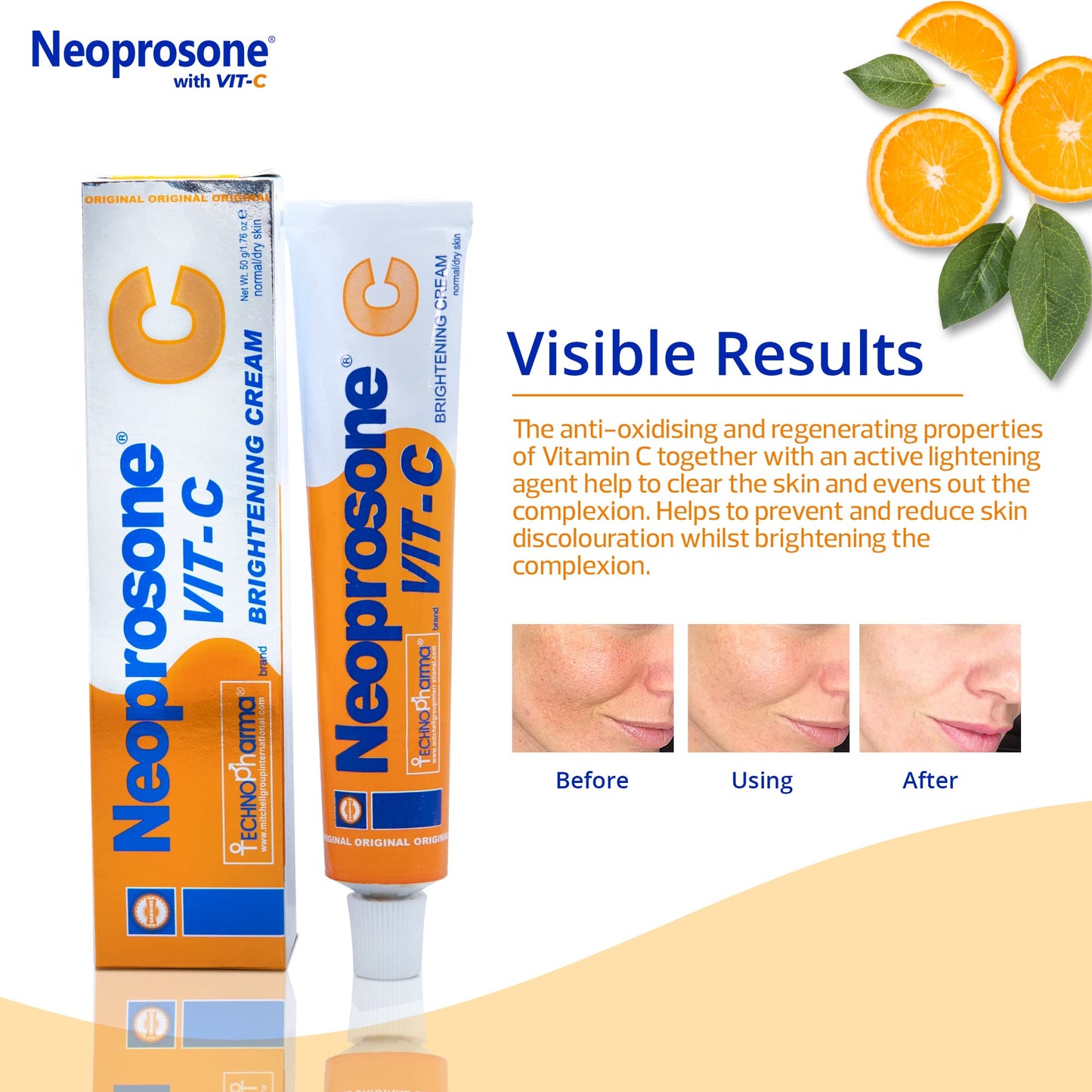 Neoprosone Skin Brightening Cream - 1.7 Fl oz / 50 ml - with Vitamin C and Alpha Arbutin Complex Beauty & Personal Care Neoprosone