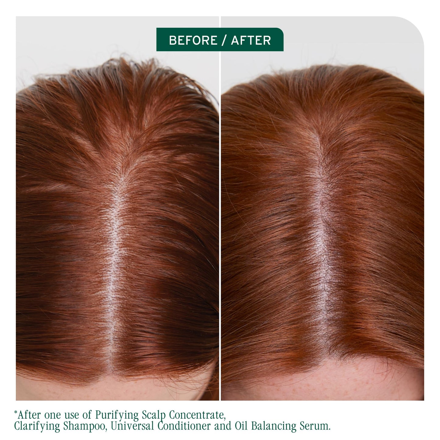 Biolage Scalp Sync Clarifying Shampoo - Residue & Buildup Remover, For Oily Scalp, Fermented Tea & Glycolic Acid, Vegan & Paraben-Free Beauty and Personal Care Biolage