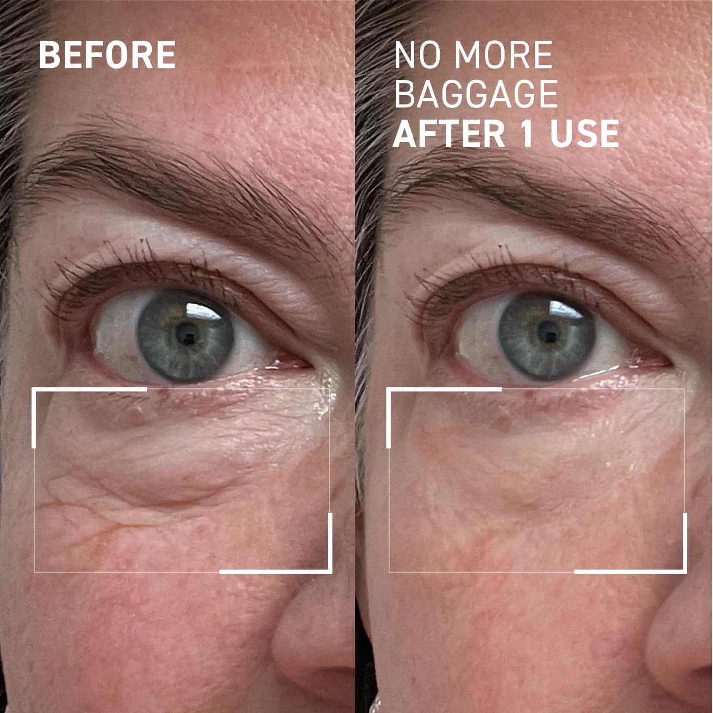 Dr. Brandt Needles No More, No More Baggage - Minimizes Under-Eye Bags, Puffiness & Dark Circles - 0.5 oz Beauty and Personal Care Dr. Brandt Skincare