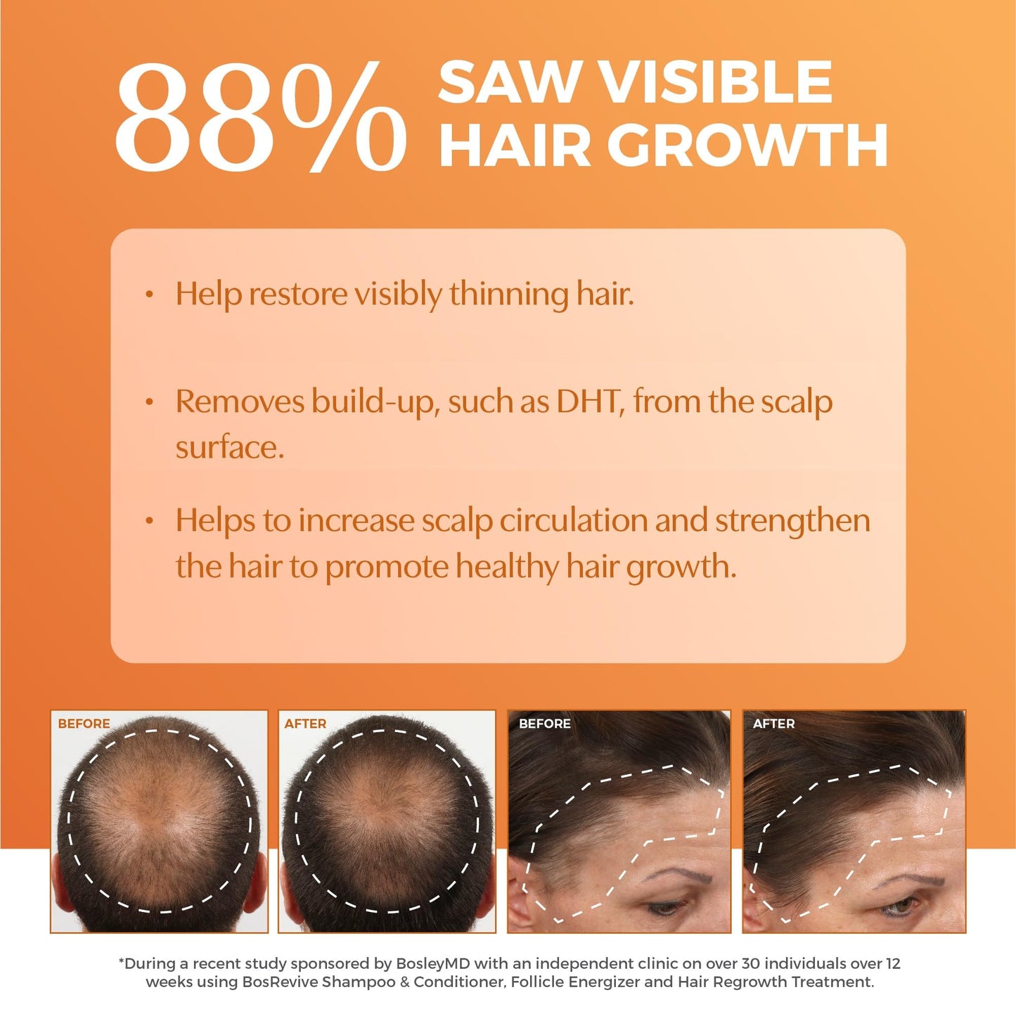 BosRevive Nourishing Shampoo for Noticeably Thinning Hair (Color Safe) - DHT Blocker, Sulfate-Free, Vegan Formula with Biotin, Saw Palmetto & Rosemary Beauty & Personal Care BosleyMD