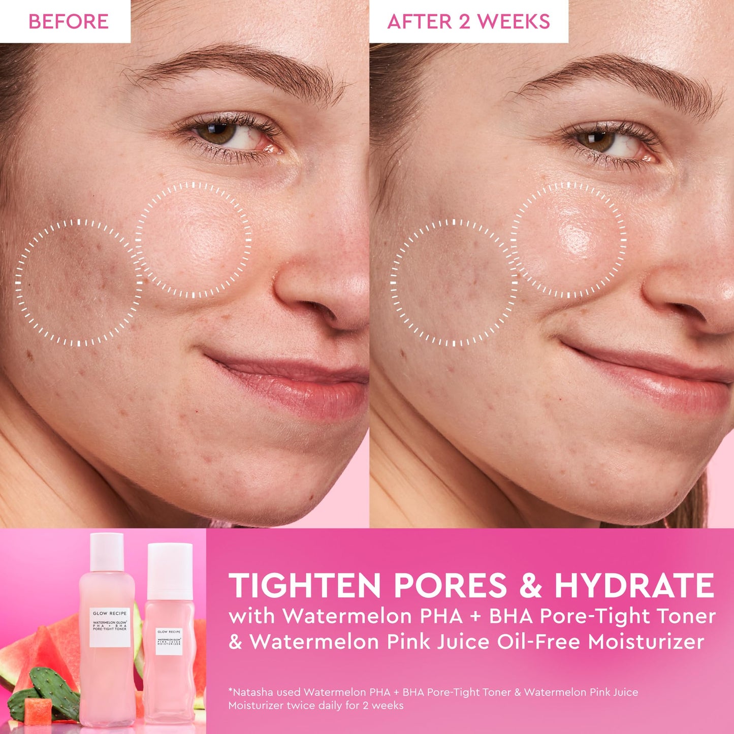 Glow Recipe PHA + BHA Face Toner, Korean Exfoliating Toner for Pores, Gentle Chemical Exfoliant + Hydrating Toner, Watermelon, Cactus Water + Glycerin Beauty & Personal Care Glow Recipe