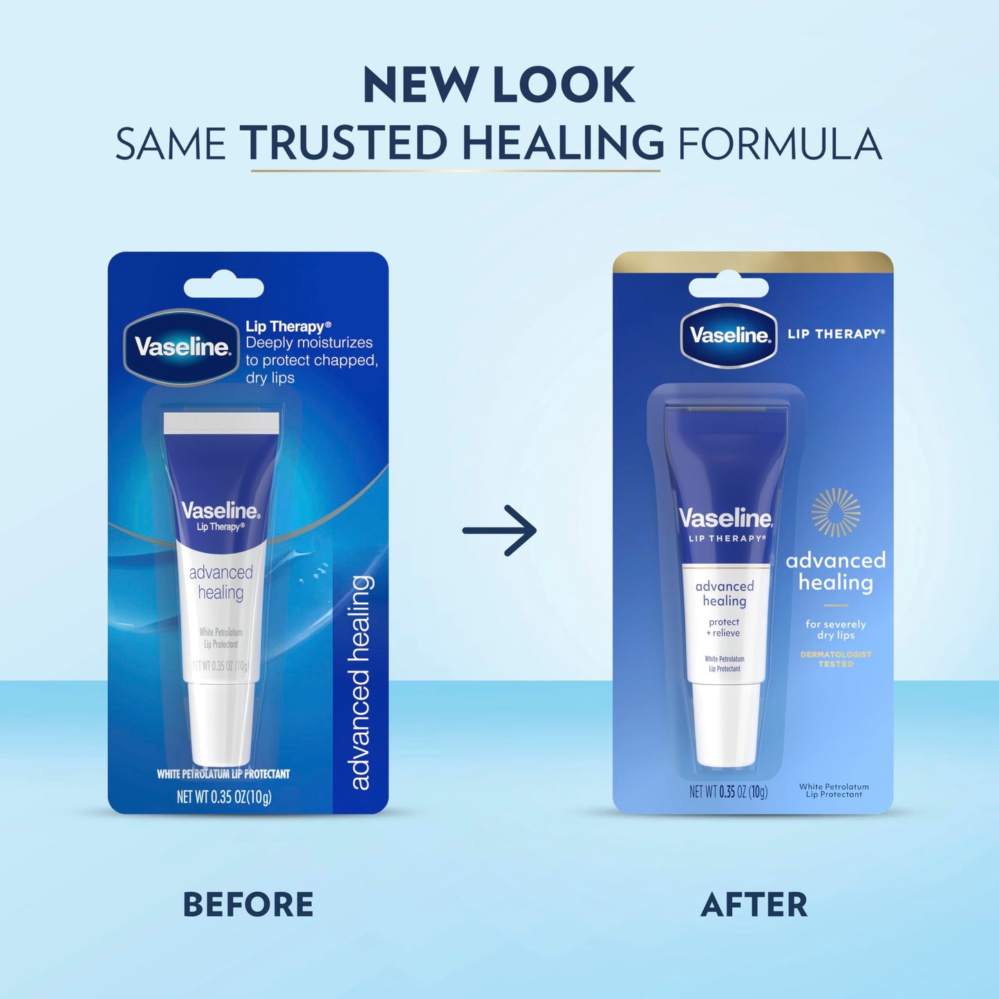 Vaseline Lip Therapy Lip Balm Tube For healthier looking lips Advanced Healing Moisturizer For Dry Lips 0.35 oz Beauty and Personal Care Vaseline