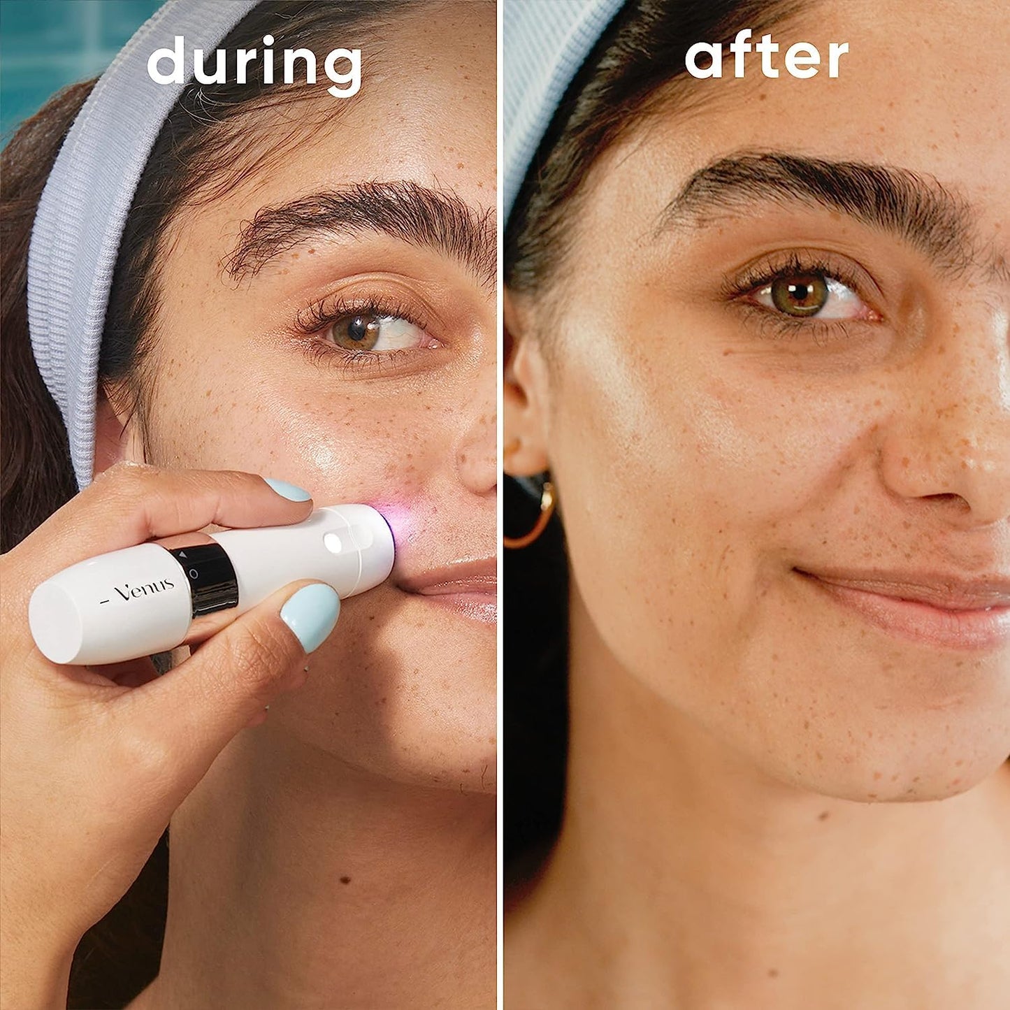 Gillette Venus Mini Facial Hair Remover for Women's Face, Portable Electric Shaver/Razor, Hair Removal for Women, Dermaplaning Tool, Trimmer Beauty and Personal Care Gillette Venus