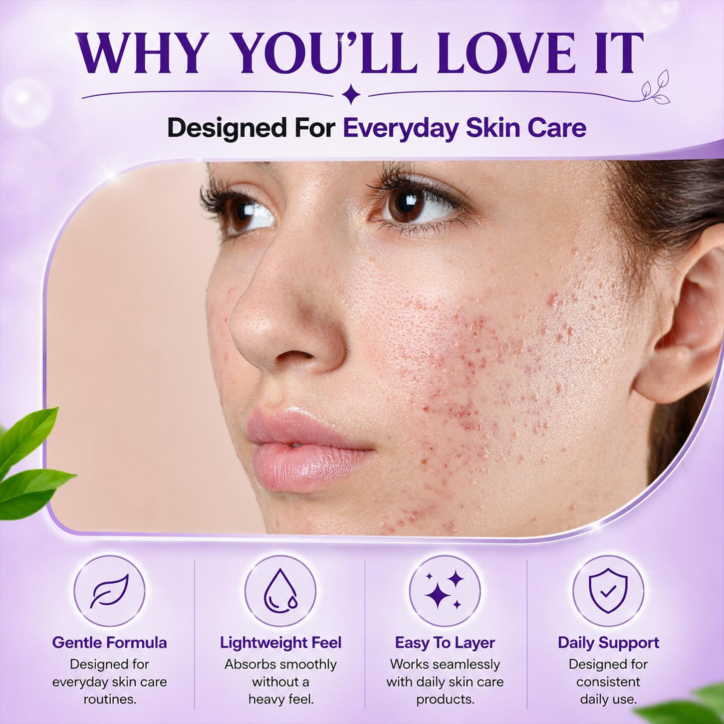 AOBBIY Azelaic Acid Cream for Face - Tone Refining Facial Cream for Skin Clarity & Smoother-Looking Skin, 1 oz Beauty and Personal Care AOBBIY