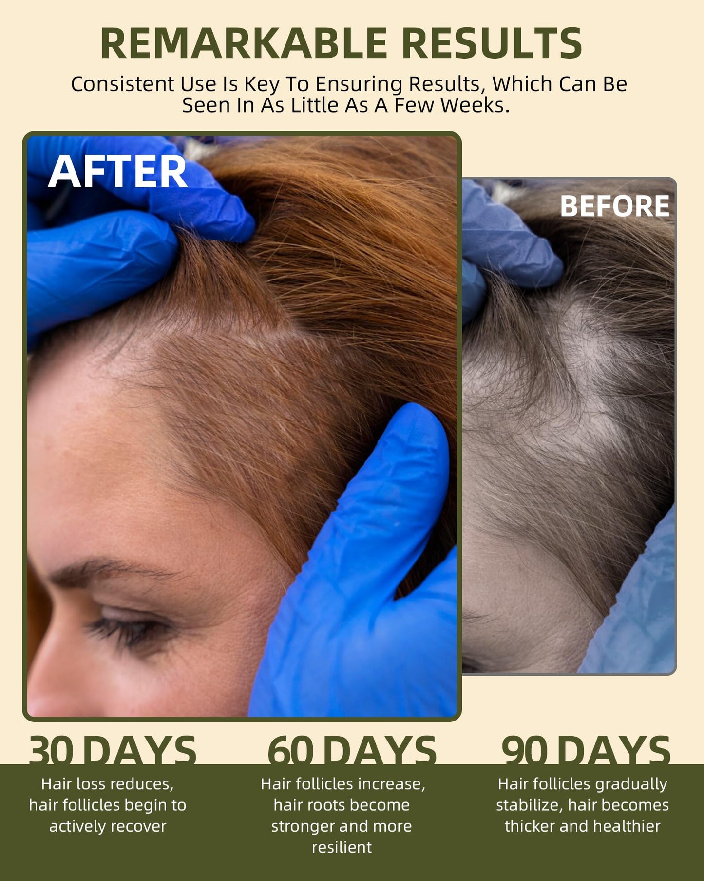 Ktintar 100% Natural Raw Batana Oil for Hair Growth, Dr Sebi Hair Growth Oil From Honduras, Thicker & Stronger Hair, Prevents Hair Loss, Eliminates Beauty & Personal Care Ktintar