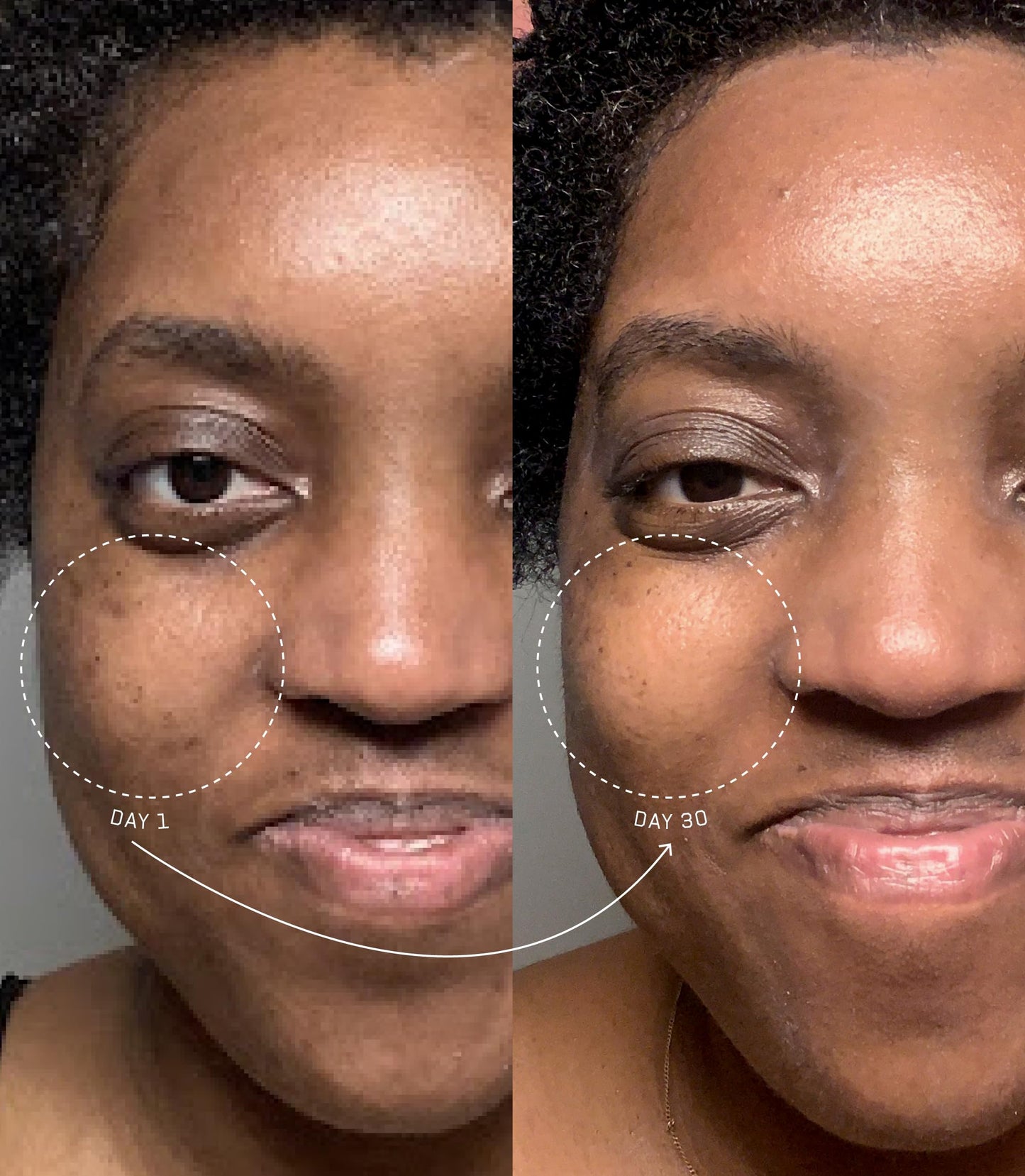 Master Plan, Collagen Renew Growth Factor Serum with Clinical Peptide, Hyaluronic Acid & Sea Kelp Bioferment - Targets Hyperpigmentation, Fine Lines Beauty & Personal Care epi.logic
